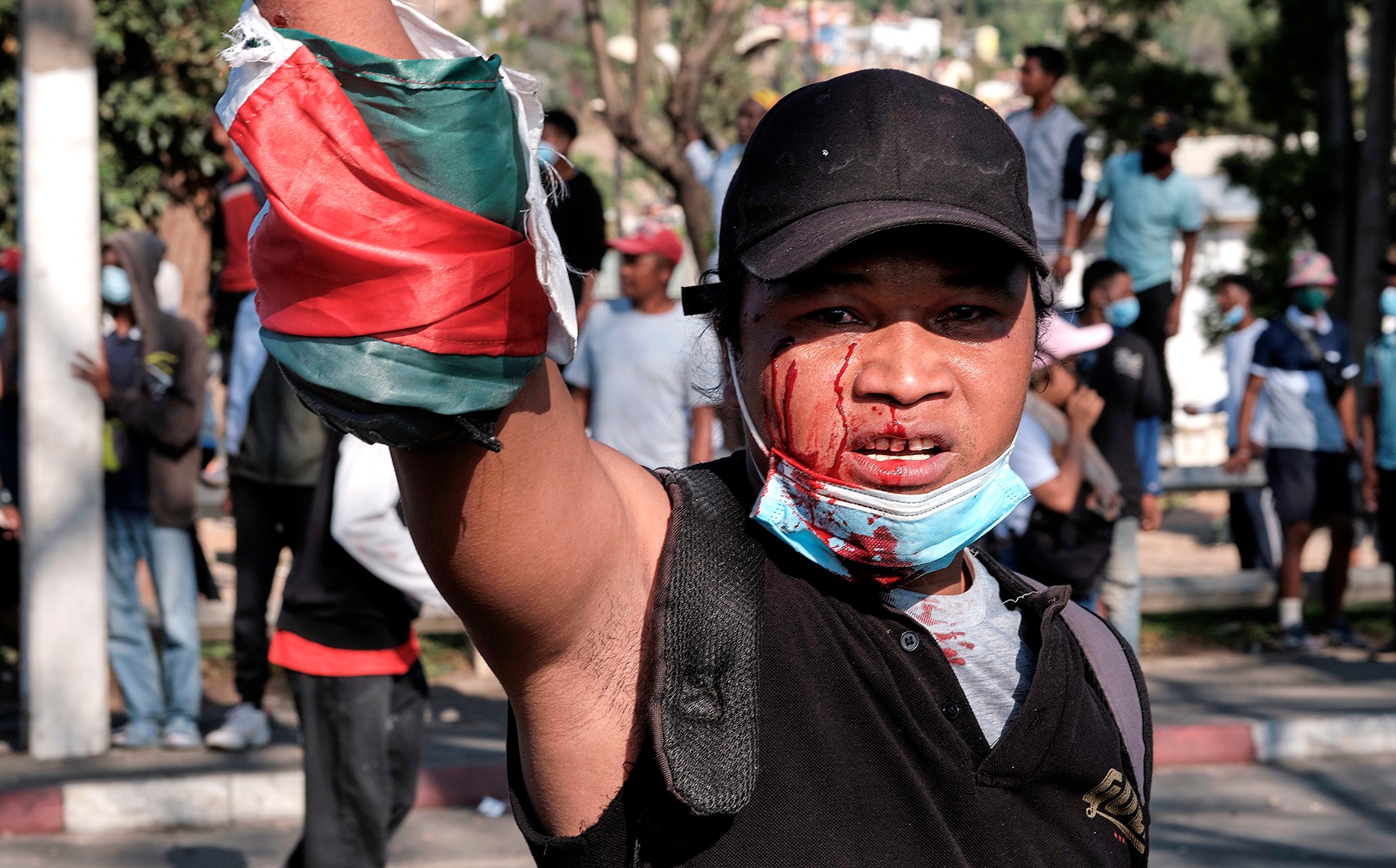 An injured man bleeds during an anti-government protest in Antananarivo, Madagascar, on 11 October 2025. Some Madagascar soldiers joined the so-called Gen Z protests, saying they would refuse any orders to shoot demonstrators. (Photo: EPA / Razafindrakoto Mamy)