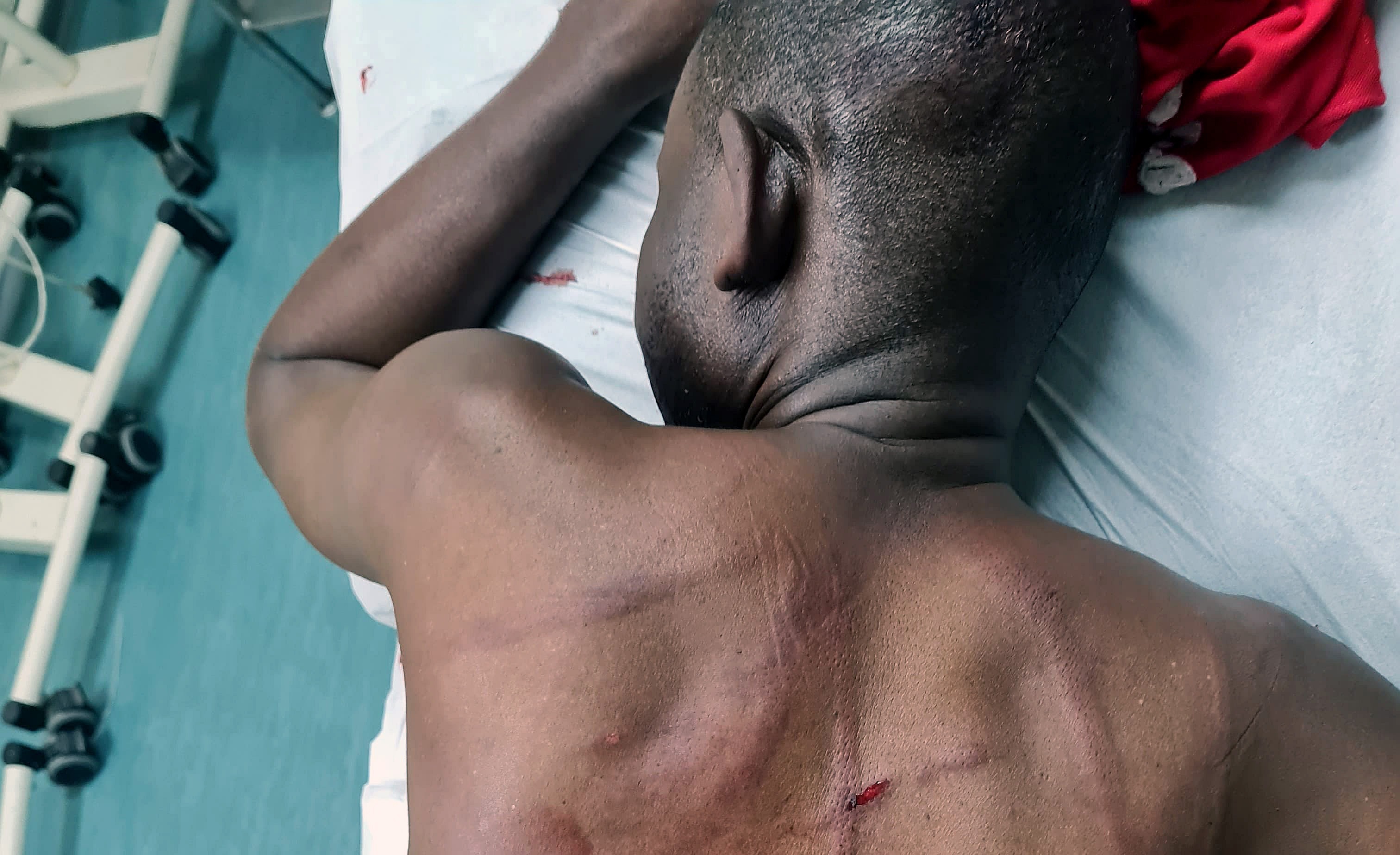 Ugandan man nearly killed by March and March mob speaks from hospital