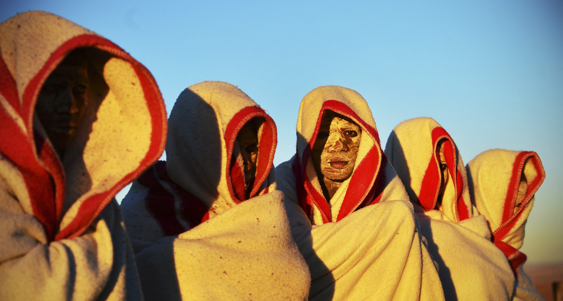 Covid-19 still affects medical and traditional circumcision in the Eastern Cape