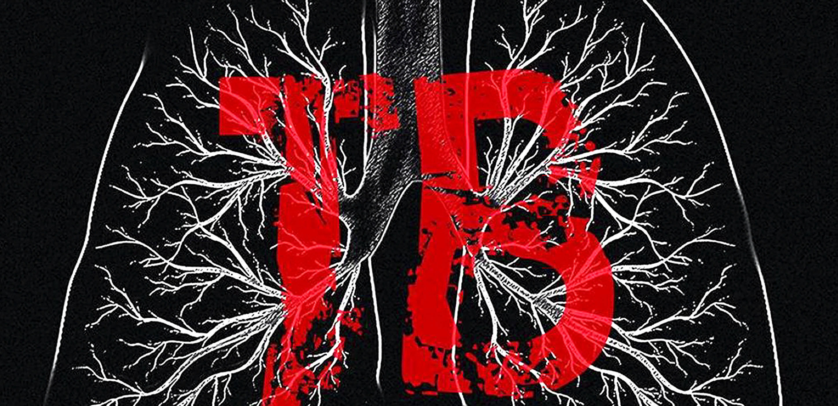 Community health workers could be the catalysts for stamping out TB stigma