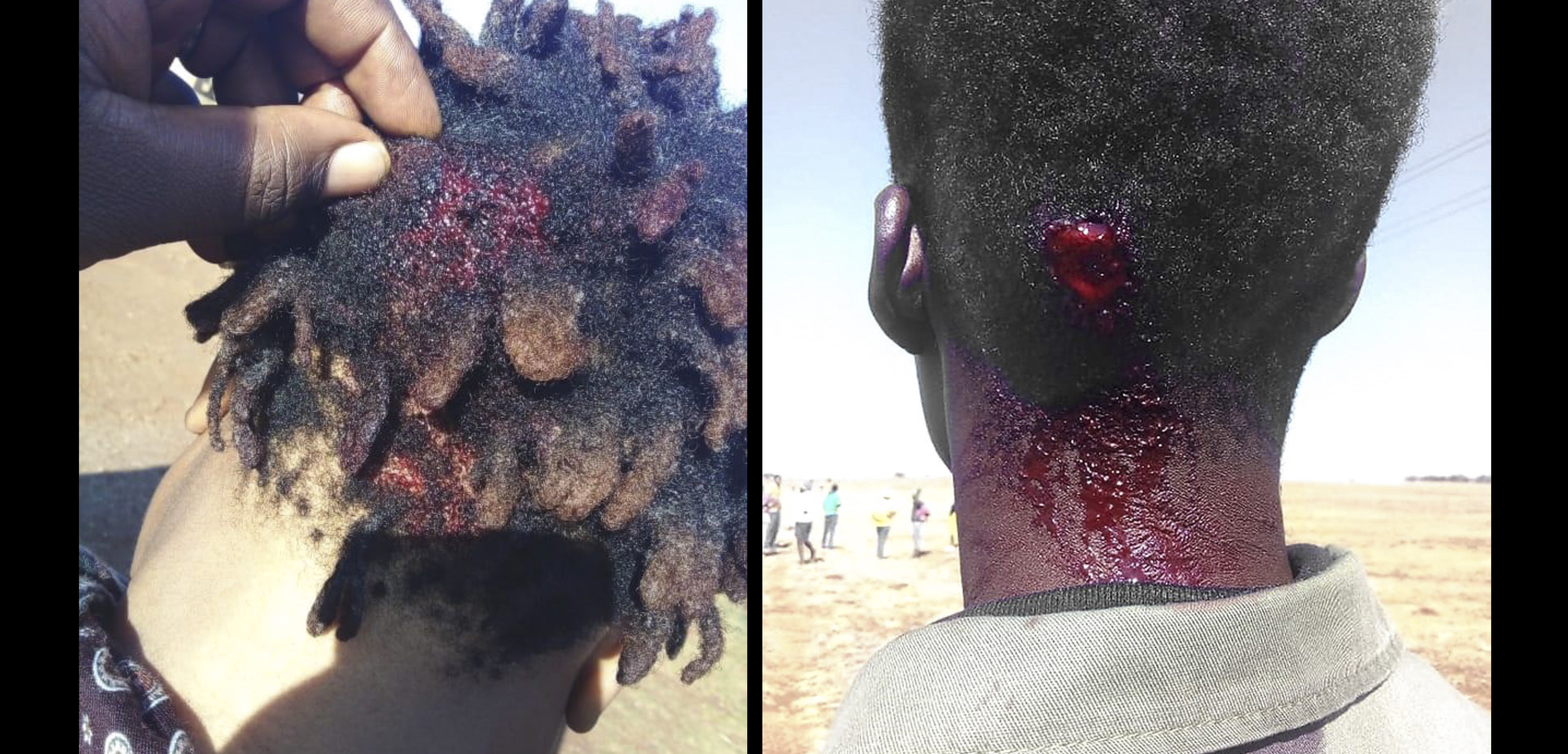 No restitution for the weary: Blaming the victim is an easy way out for failure to deliver the promised land