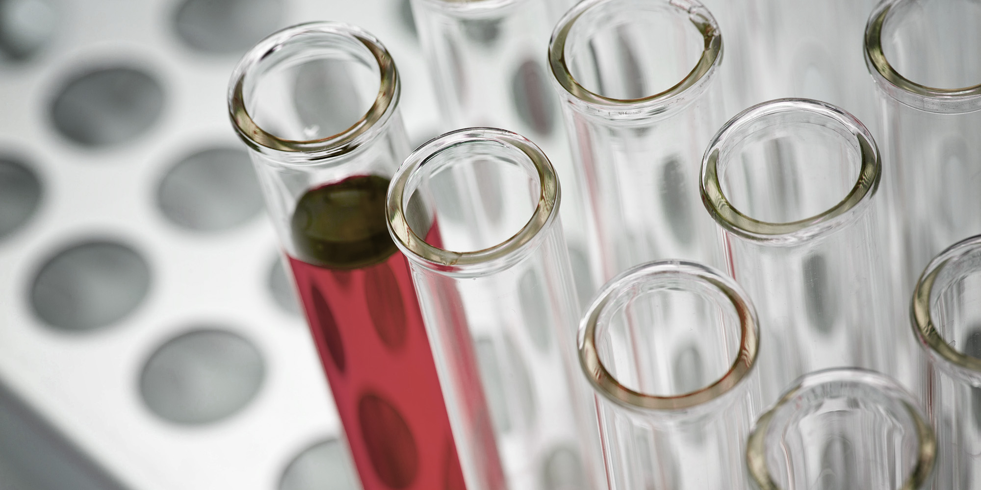 DNA samples gathering dust: DA says the police must work with the private sector to resolve the backlog