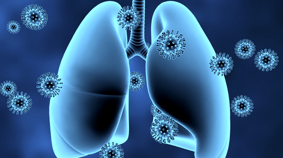 Sound the alarm: We are failing to meet targets to beat TB, but Khayelitsha’s care model during Covid-19 shows exactly how it should be done