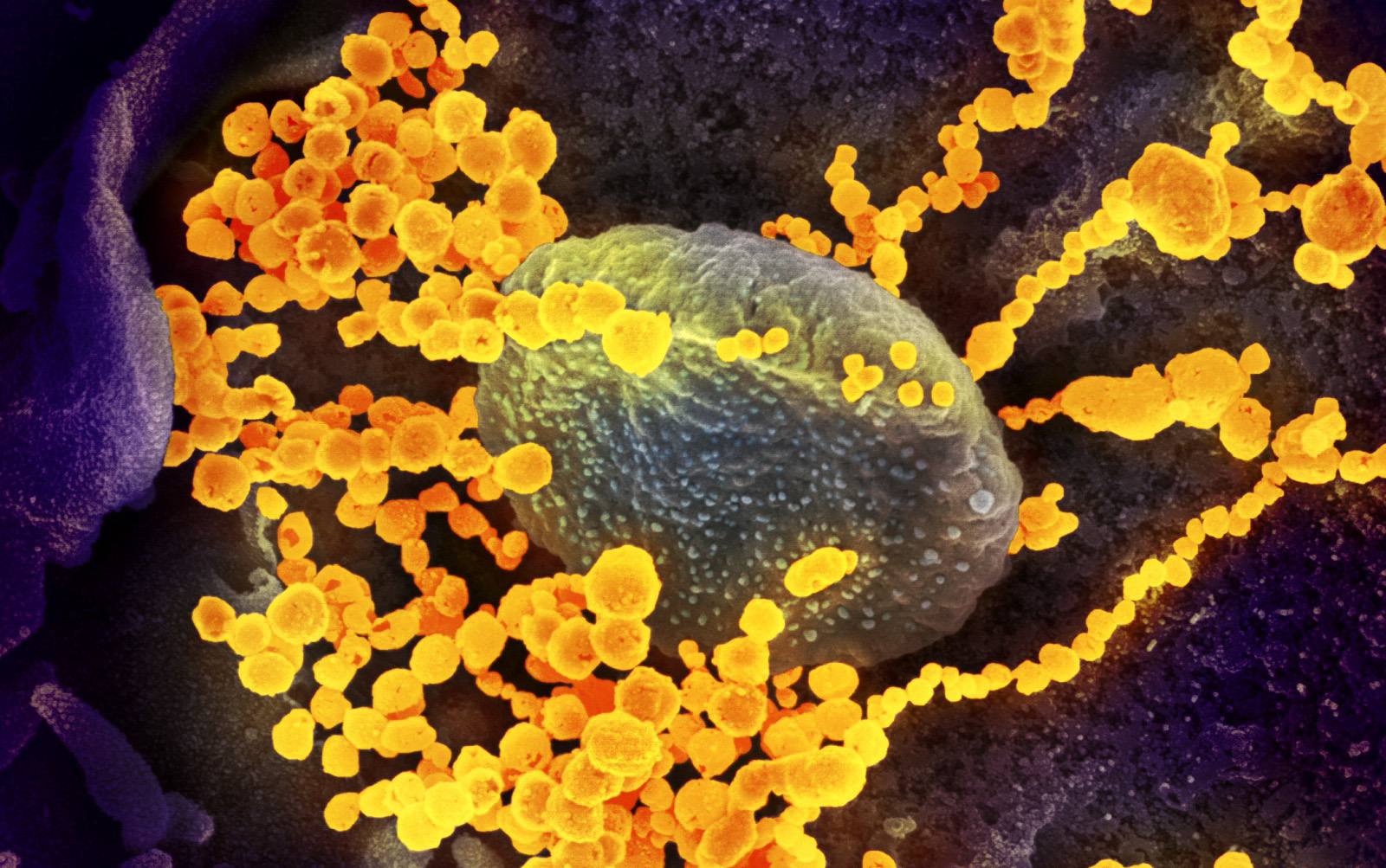 Prof Salim Abdool Karim: SA was 'not caught with our pants down', while hospital numbers continue to show unvaccinated at higher risk