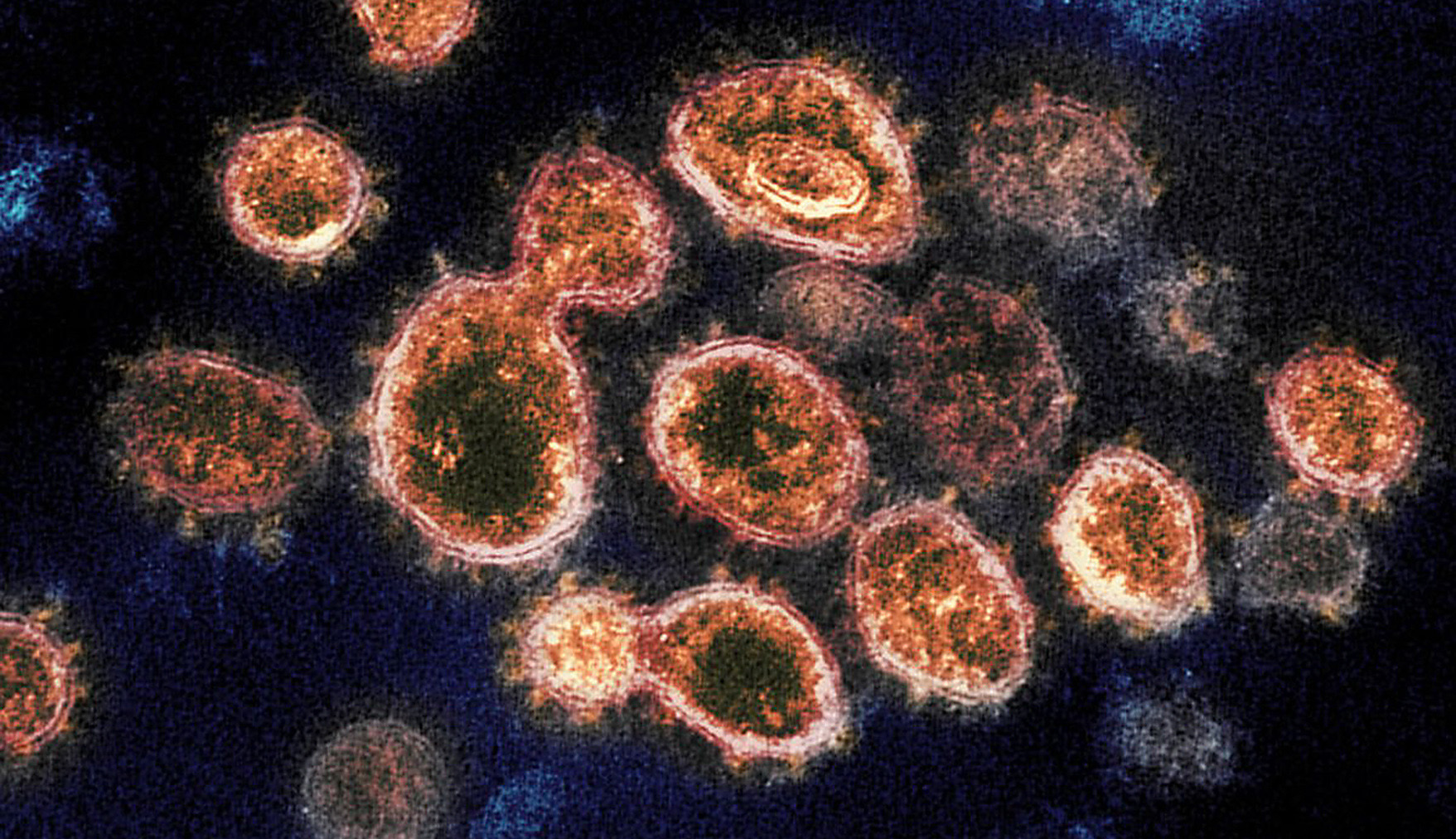 Latest Tshwane Covid-19 data show fewer severe cases so far than in previous waves