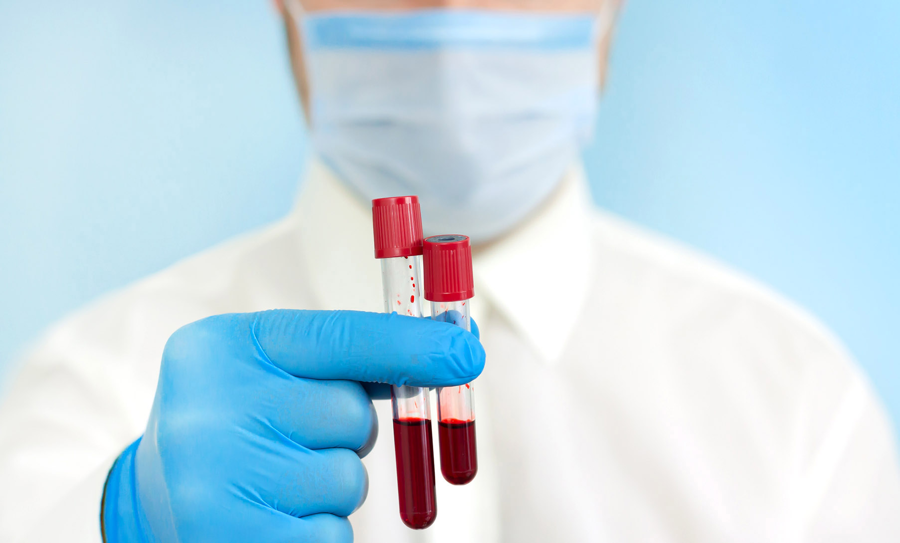 Lives depend on South Africa finding more local stem cell donors