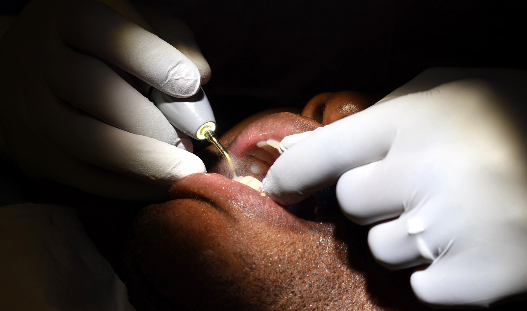 An investment account reserved for dental expenses will keep you smiling