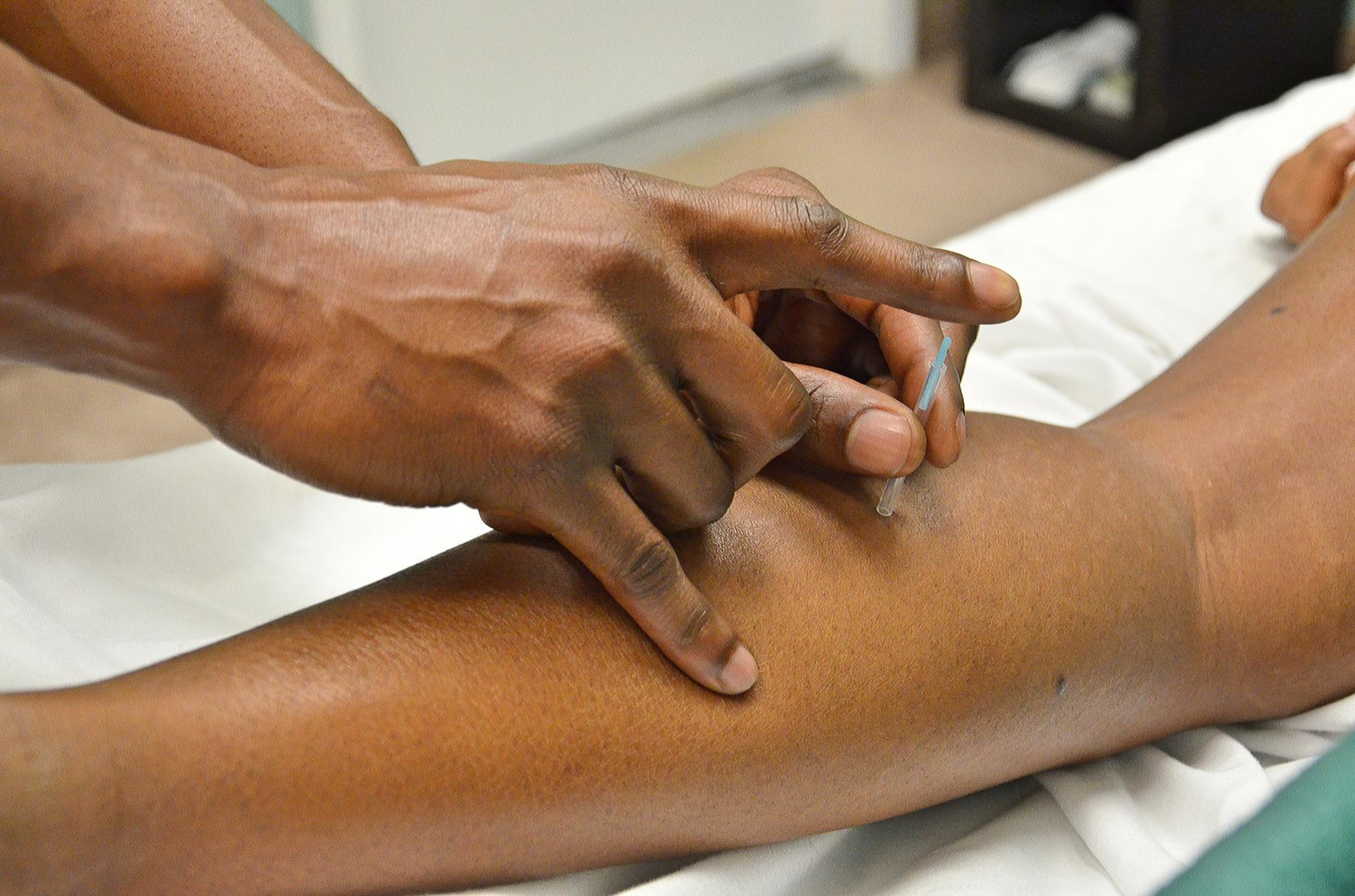 Physio ‘dry needling’ and acupuncture – what’s the difference and what does the evidence say?