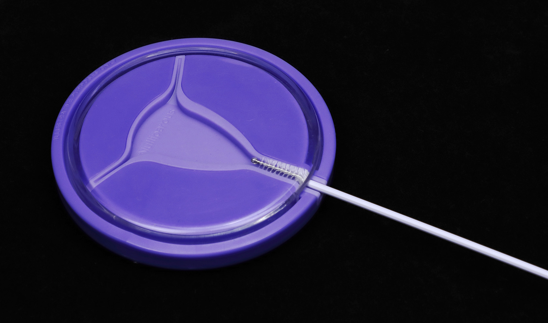 Cervical cancer a disease of poverty and inequity — inclusive treatment access is essential