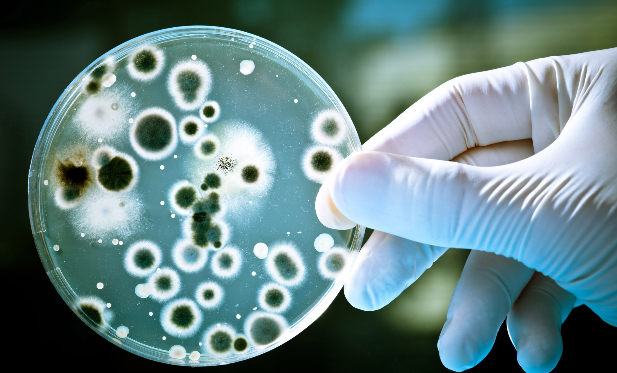 Superbugs could cost you an arm and a leg: Why hospitals need more money to fight drug resistance