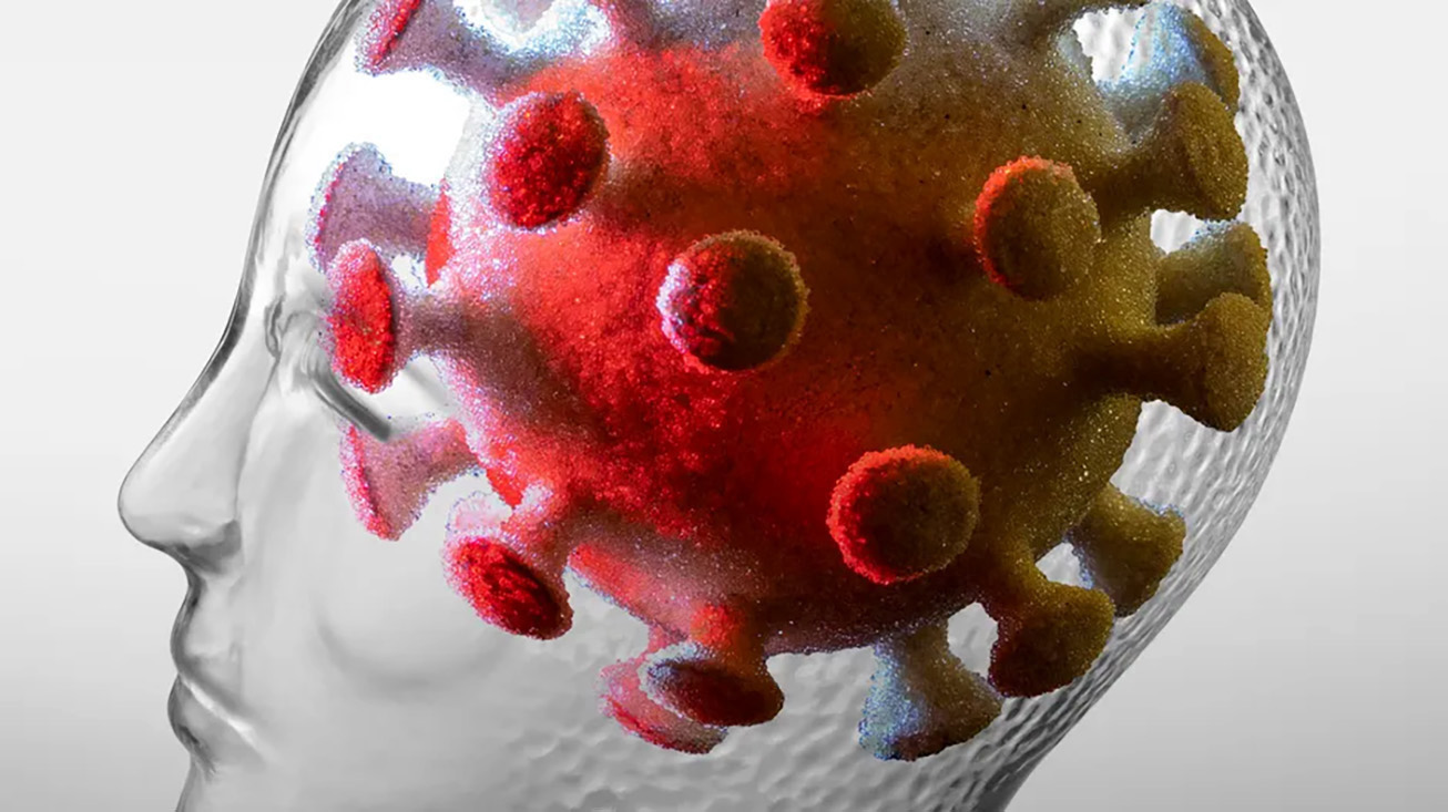 Still many unknowns, but long Covid is real and deserves support for rehabilitation, says expert