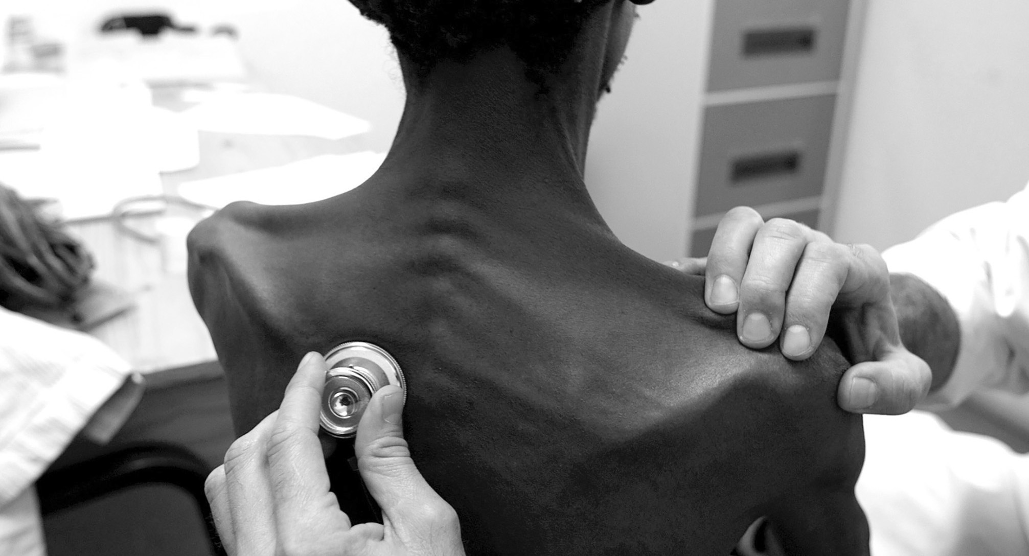 TB preventive therapy supply constraints delay wider roll-out of shorter regimen