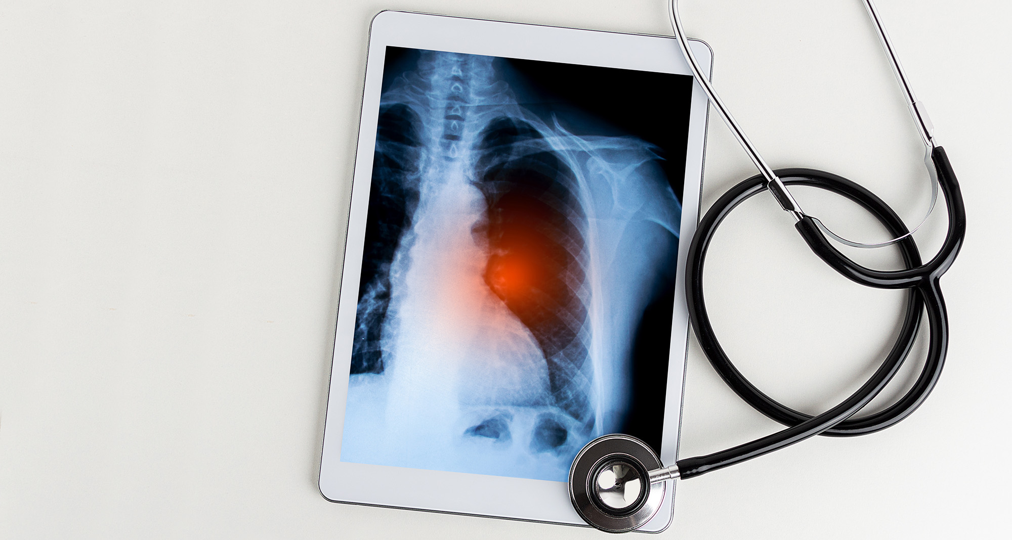 How good is your province at curing the most drug-resistant TB? Check this map to find out