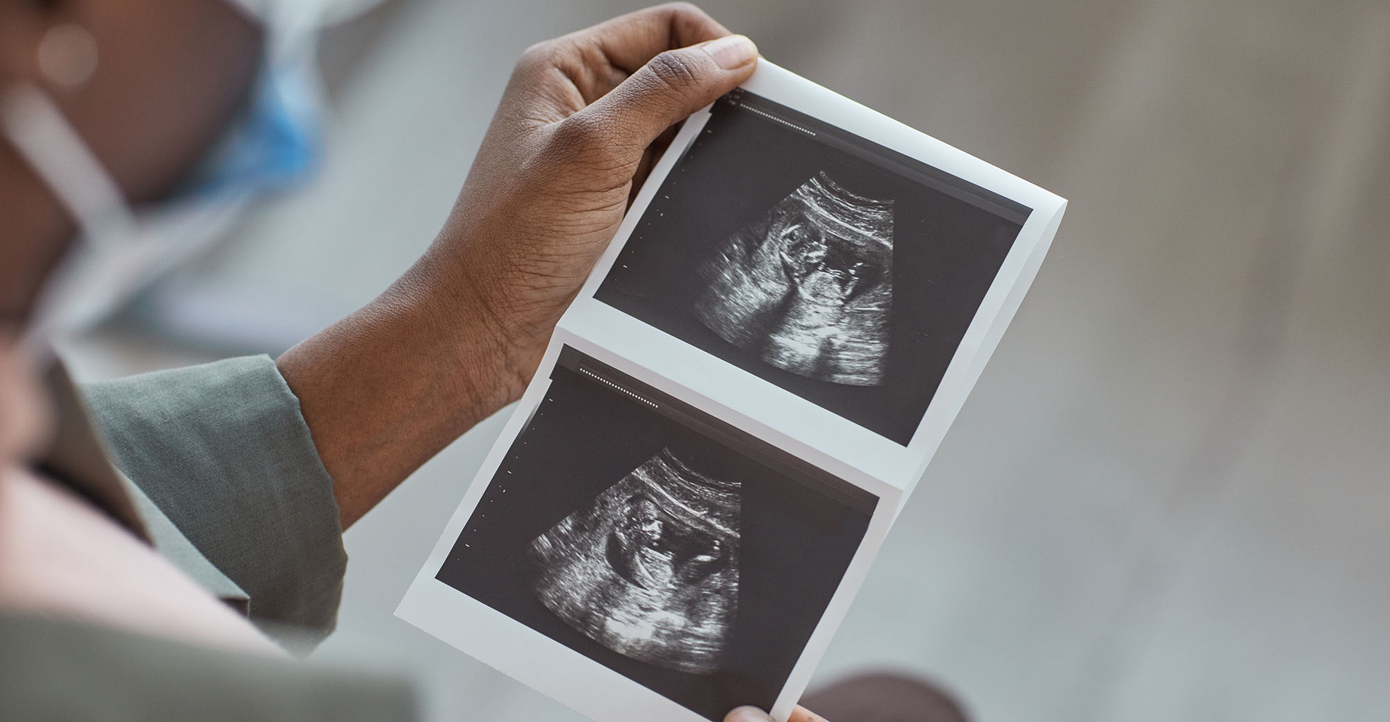 Tygerberg hospital faces Caesarean section backlog crisis