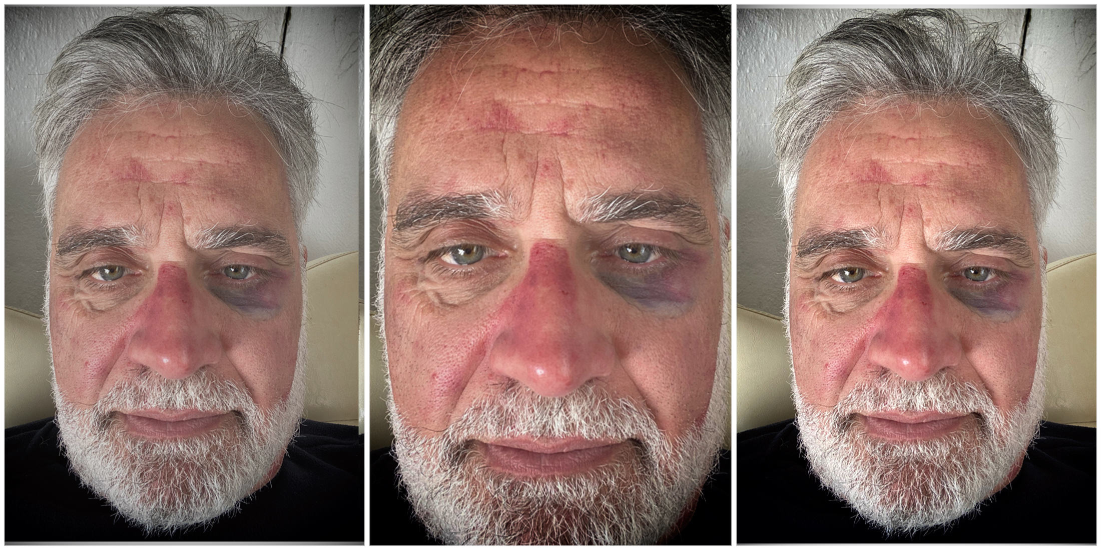 Sars whistleblower Johann van Loggerenberg attacked and robbed while cycling