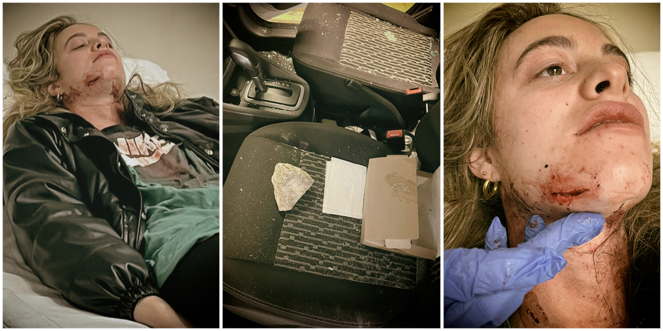 Student latest victim of N2 rock-throwing incident on Cape Town’s 'Hell Run'