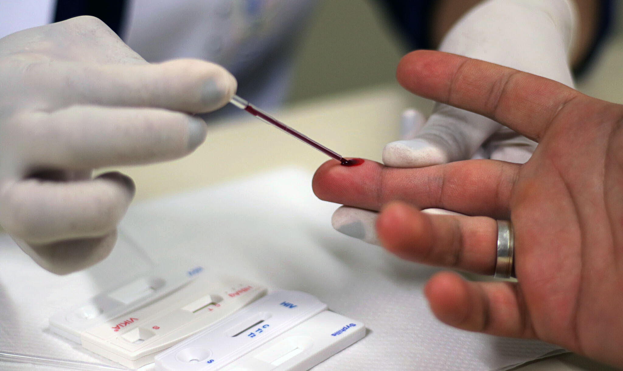 South Africa faces alarming drop in HIV testing rates linked to US funding withdrawal
