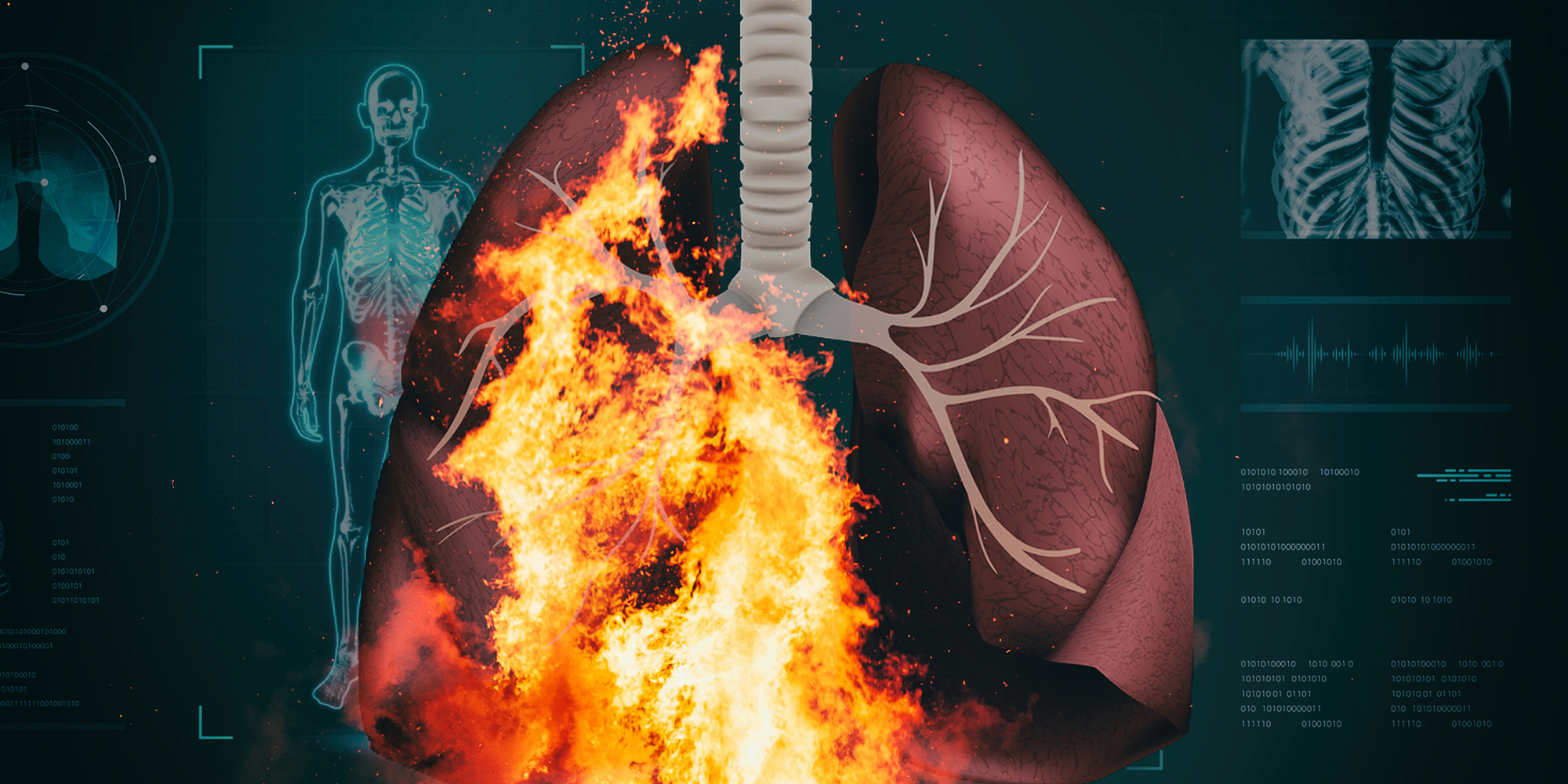 UPL chemical inferno ‘more than doubles’ risk for heart disease and lung cancer in parts of Durban