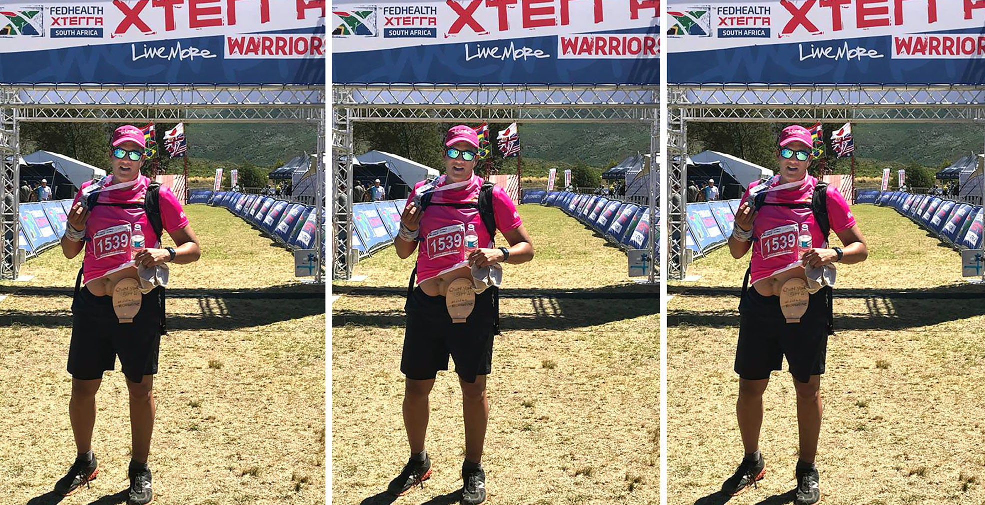 The ethical dilemma some surgeons in public healthcare face – save lives or prevent indignity and humiliation