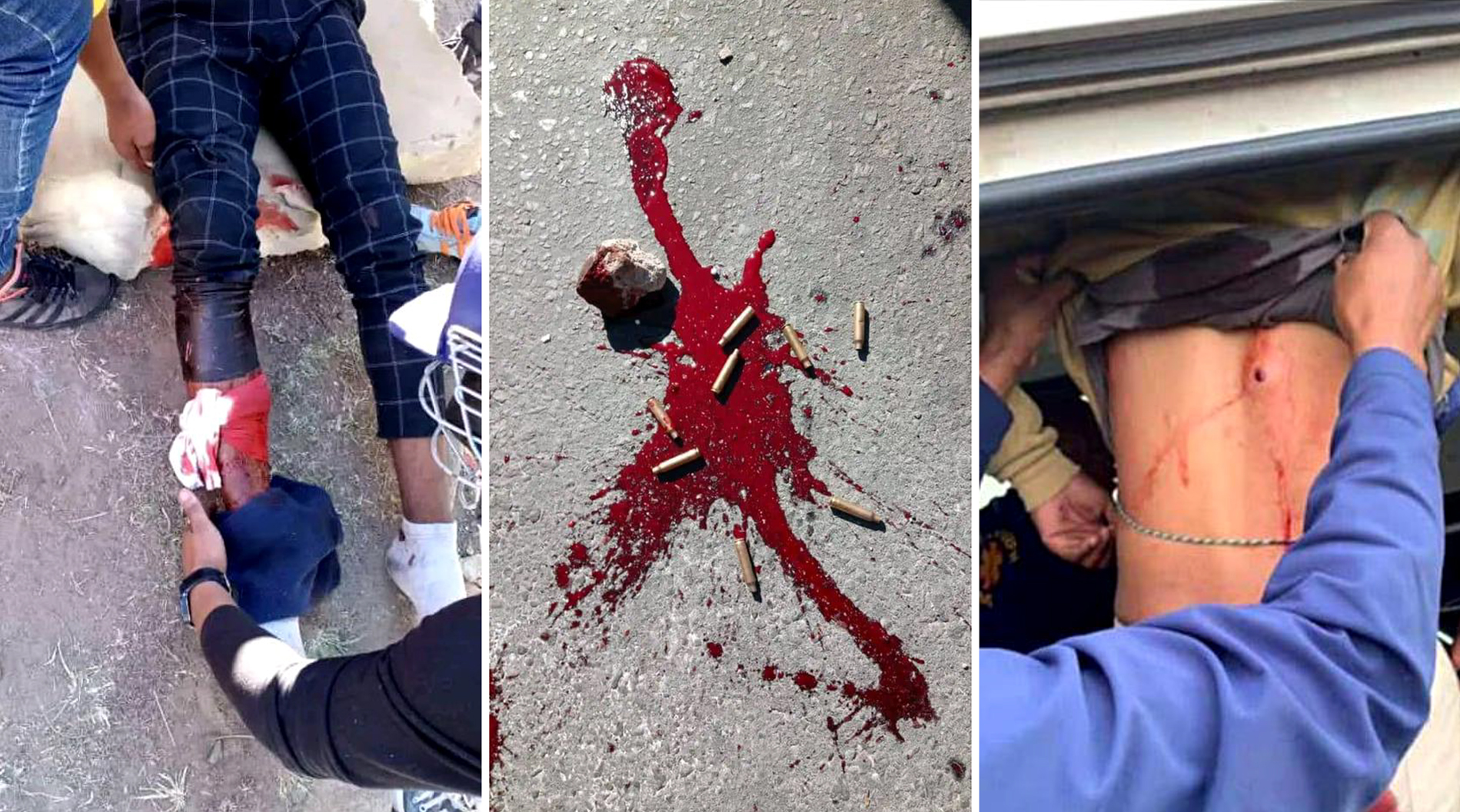 Mthatha students claim police shot at them with live ammunition during chaotic protest on N2 in May