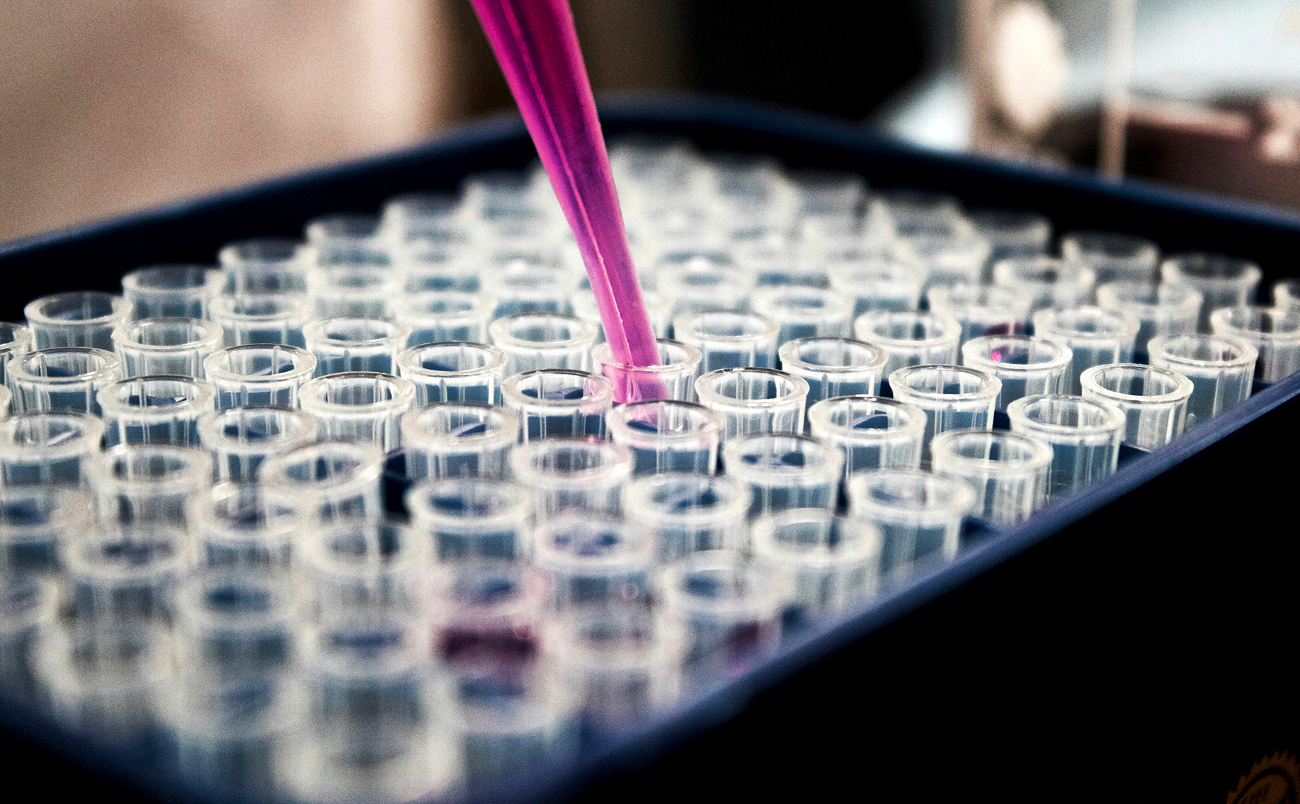 SA’s HIV burden a concern as new mpox strain spreads in DRC – but much still unknown