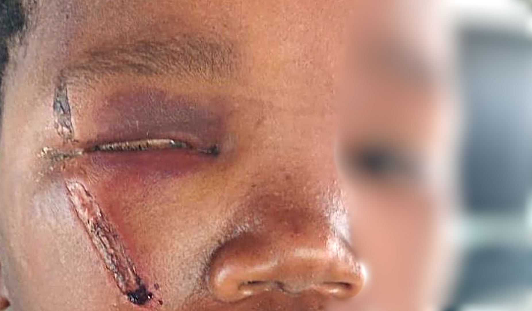 Lutzville police officer out on bail after allegedly assaulting 13-year-old with a sjambok