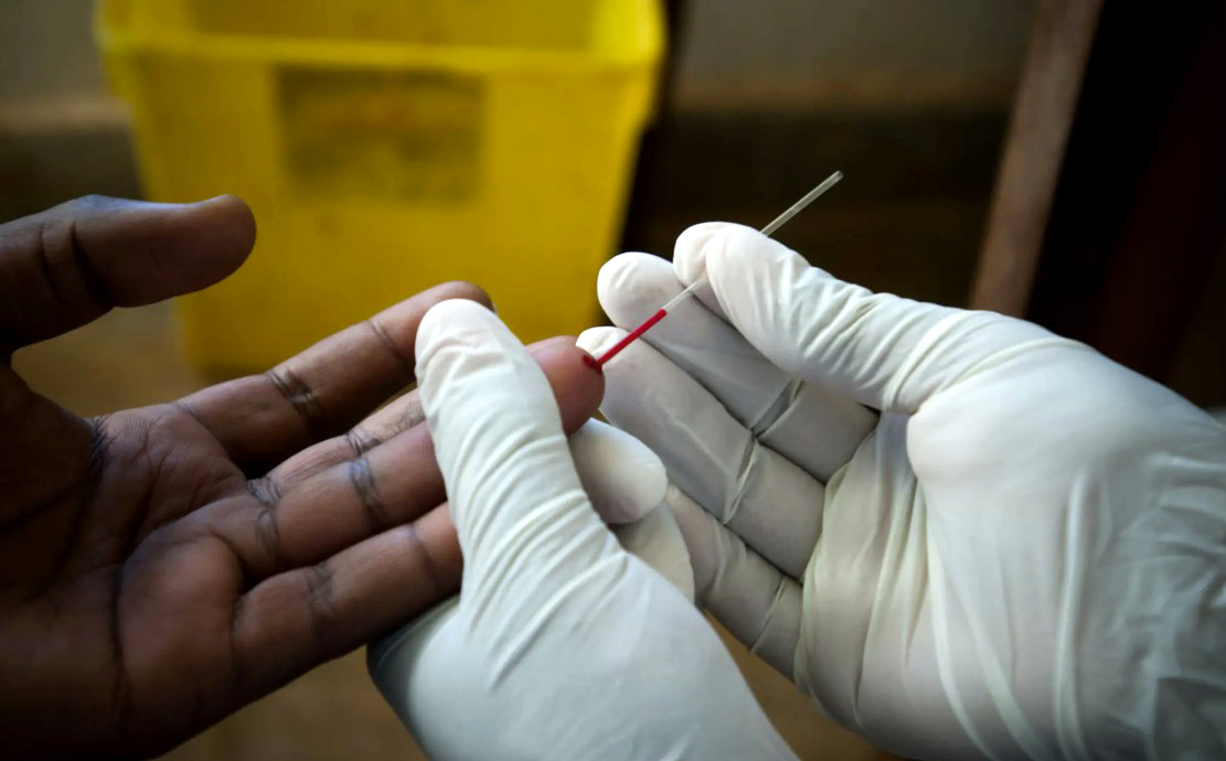 South Africa's HIV challenge: progress towards 2030 goals requires urgent action and innovation