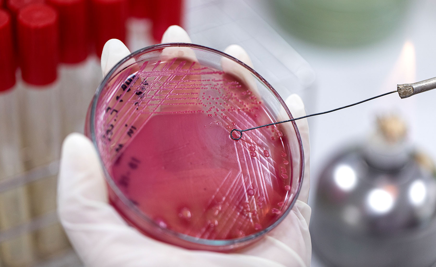 How vaccines could help combat drug resistance and transform SA's public health outcomes