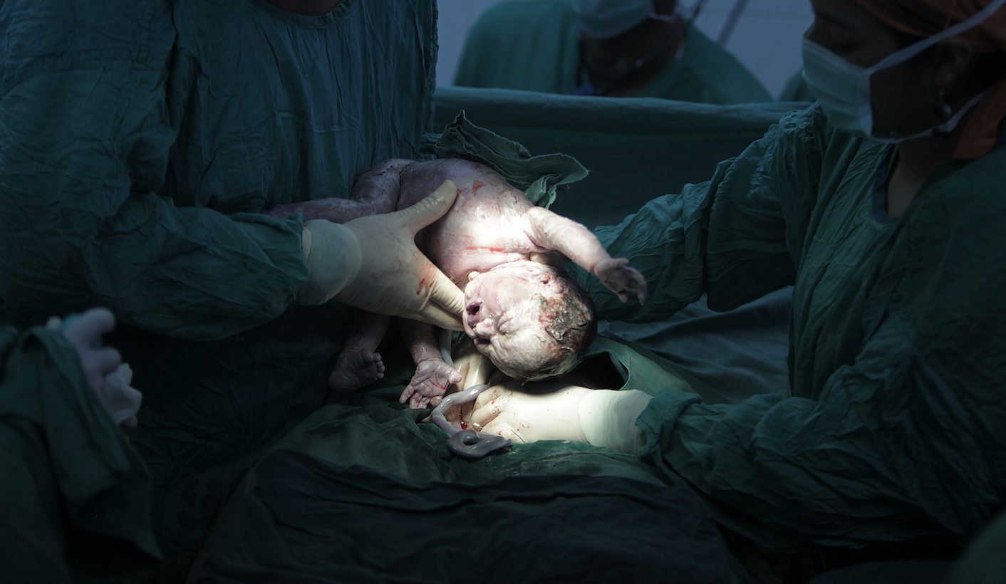 Insufficient evidence to support health claims associated with eating placenta