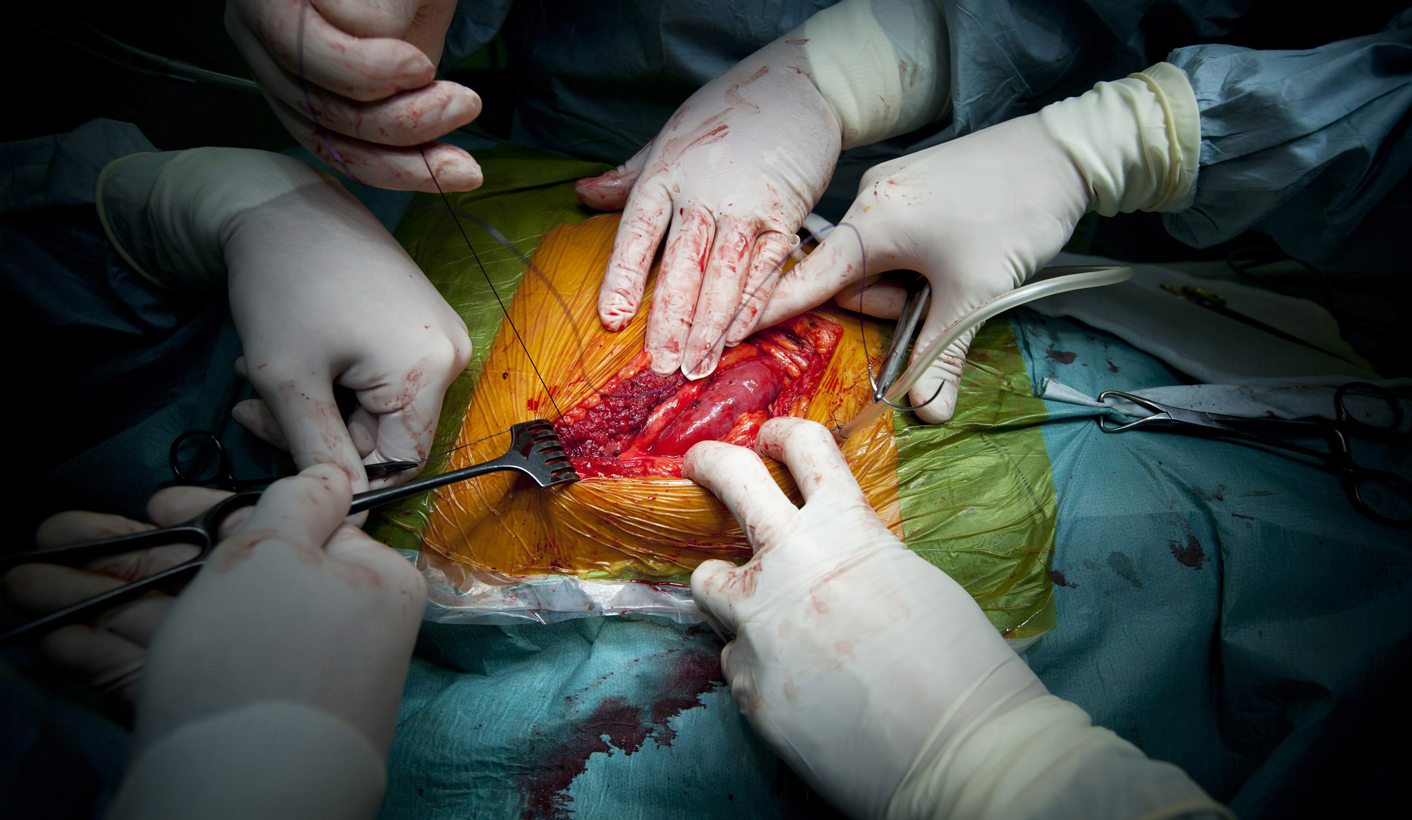 Saving lives: South Africa joins paired kidney exchange revolution