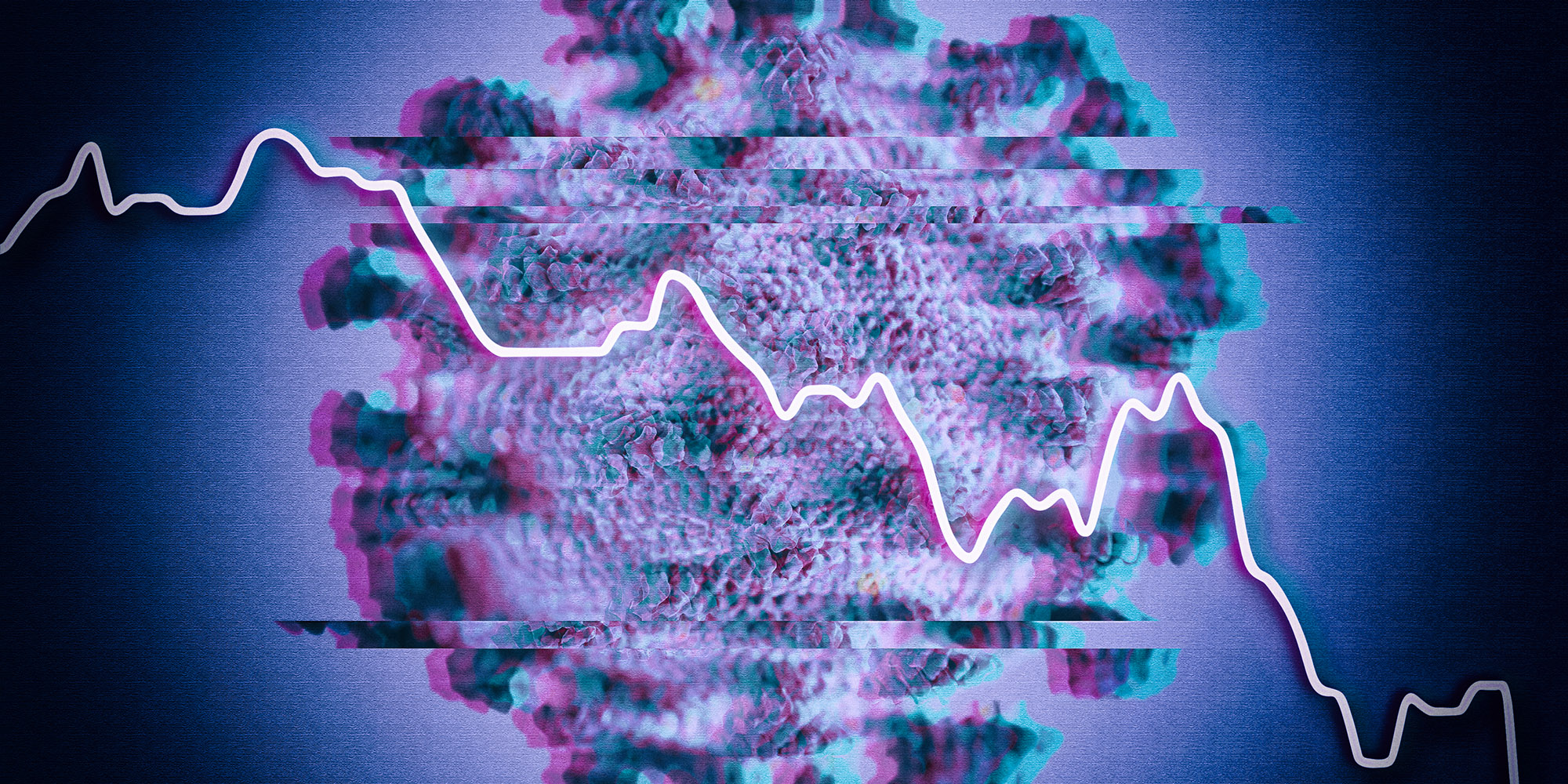 US economy contracts sharply — and South Africa’s will fare even worse