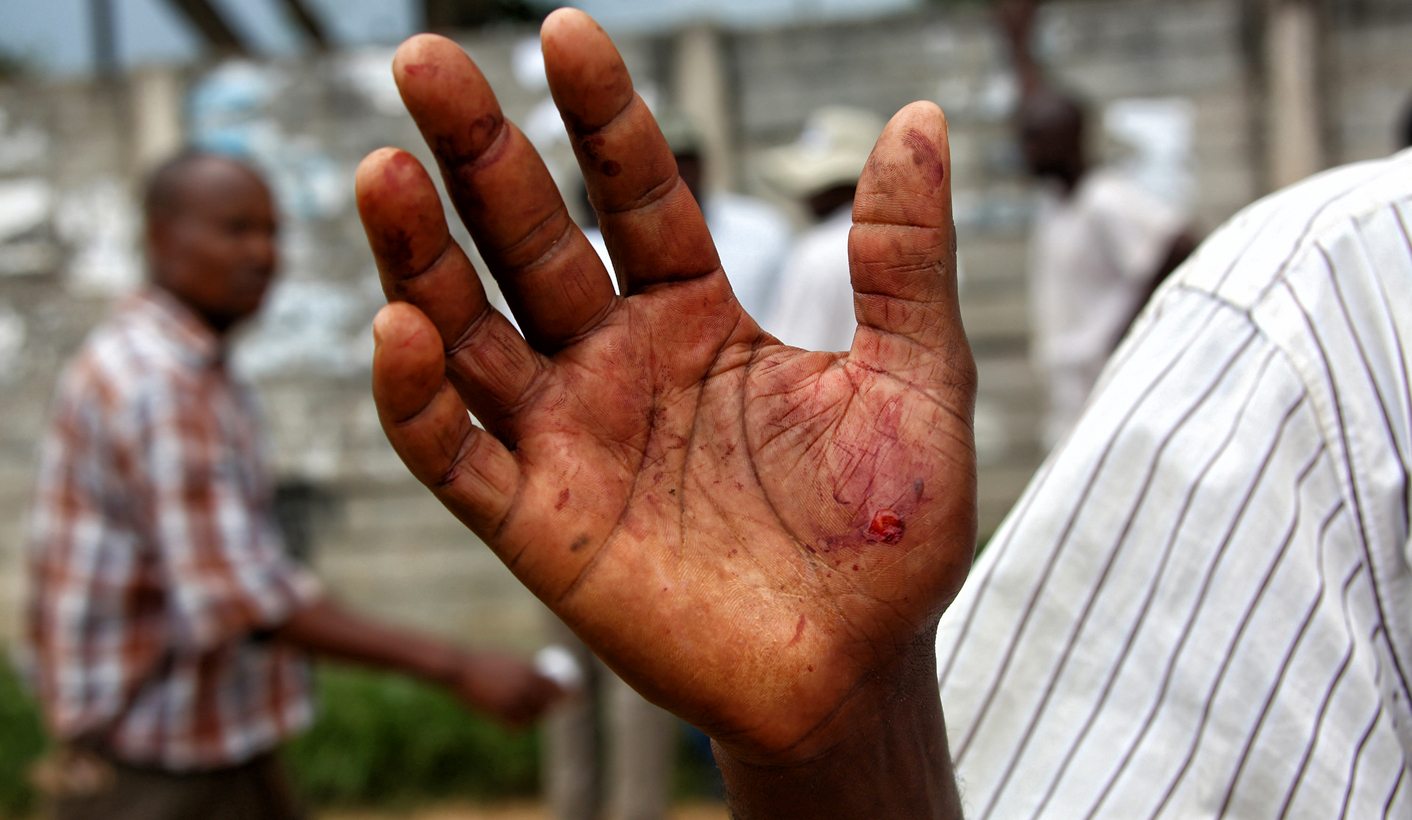 #AfricanLivesMatterToo: The romanticising of a continent’s failures