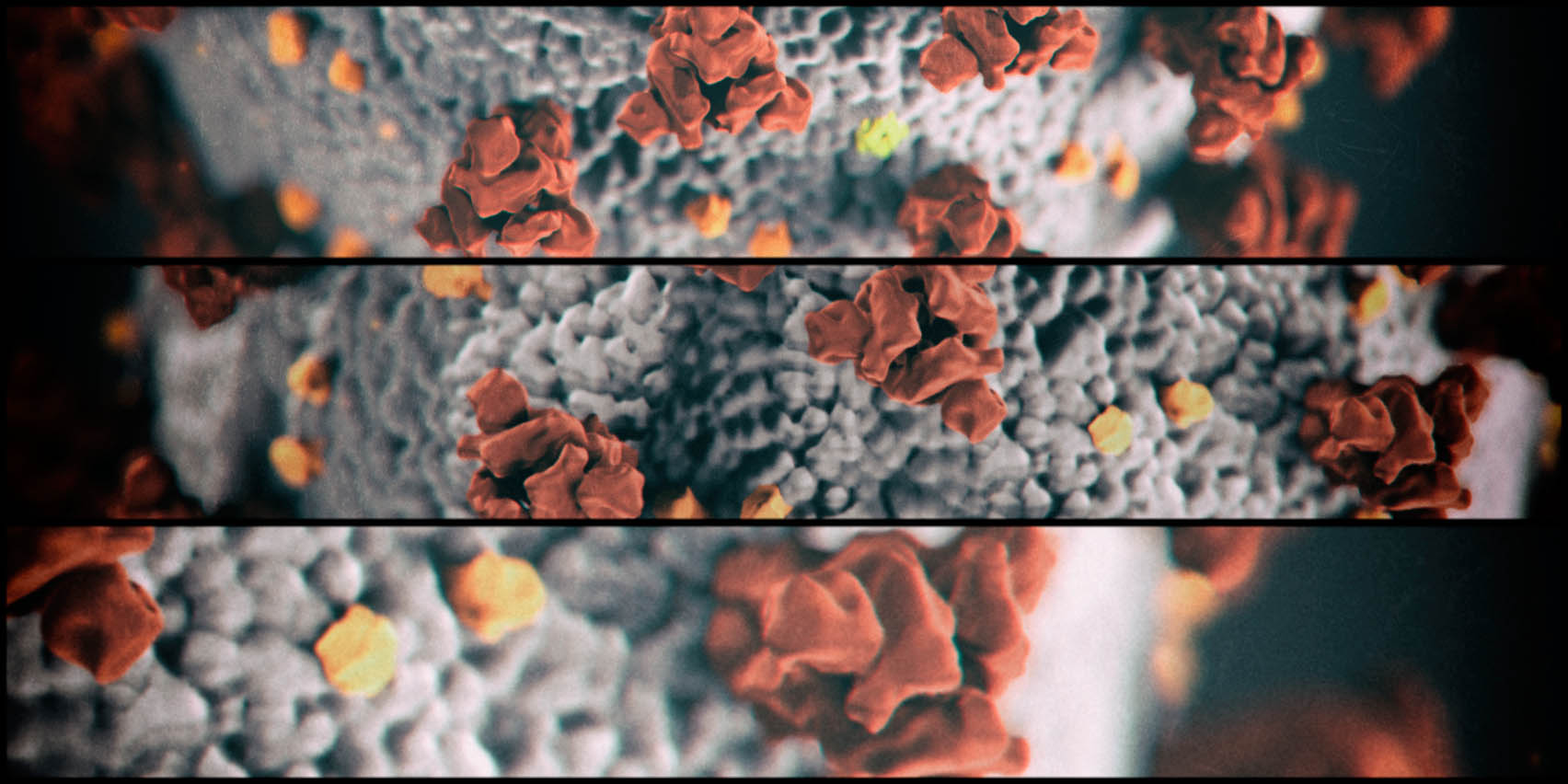 Will Africa’s economies buckle under the Coronavirus?