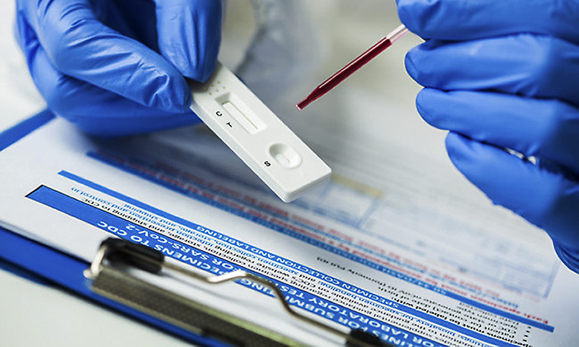 The False Hope of Antibody Testing