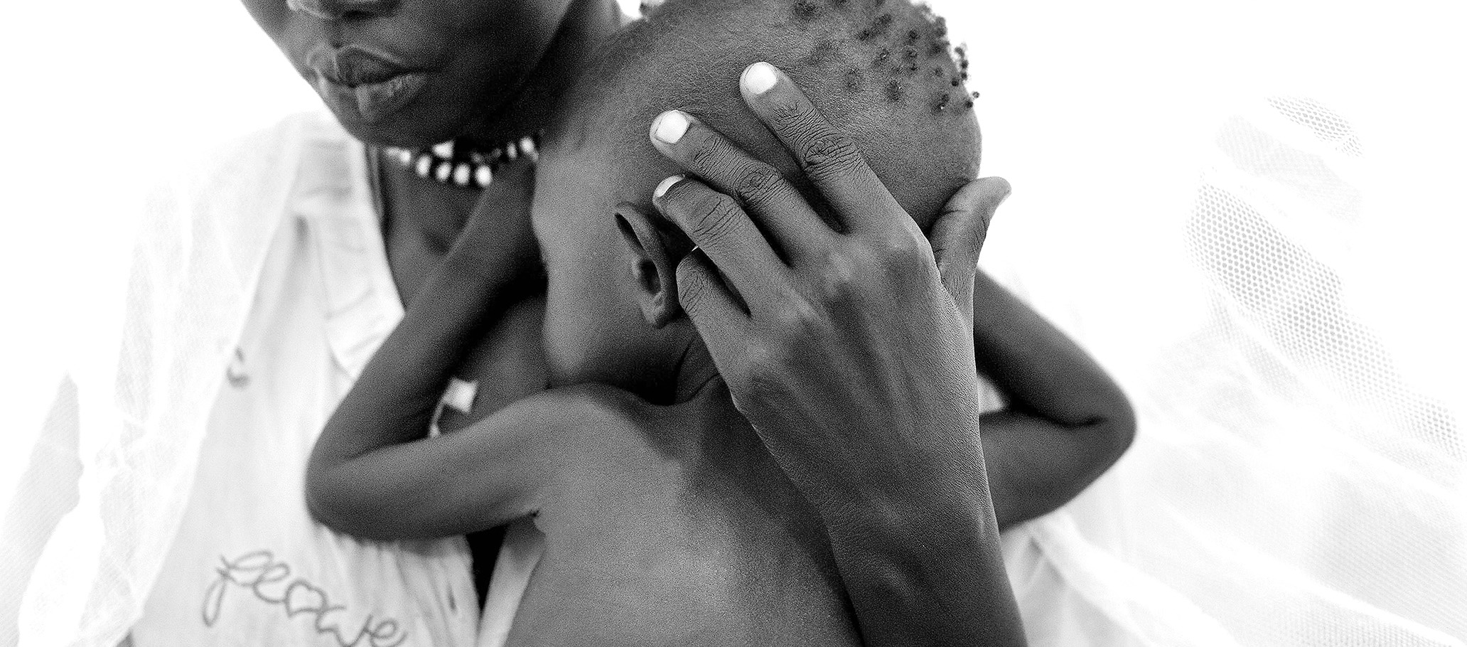 South Africa’s children are too short and too fat, going against the global trend