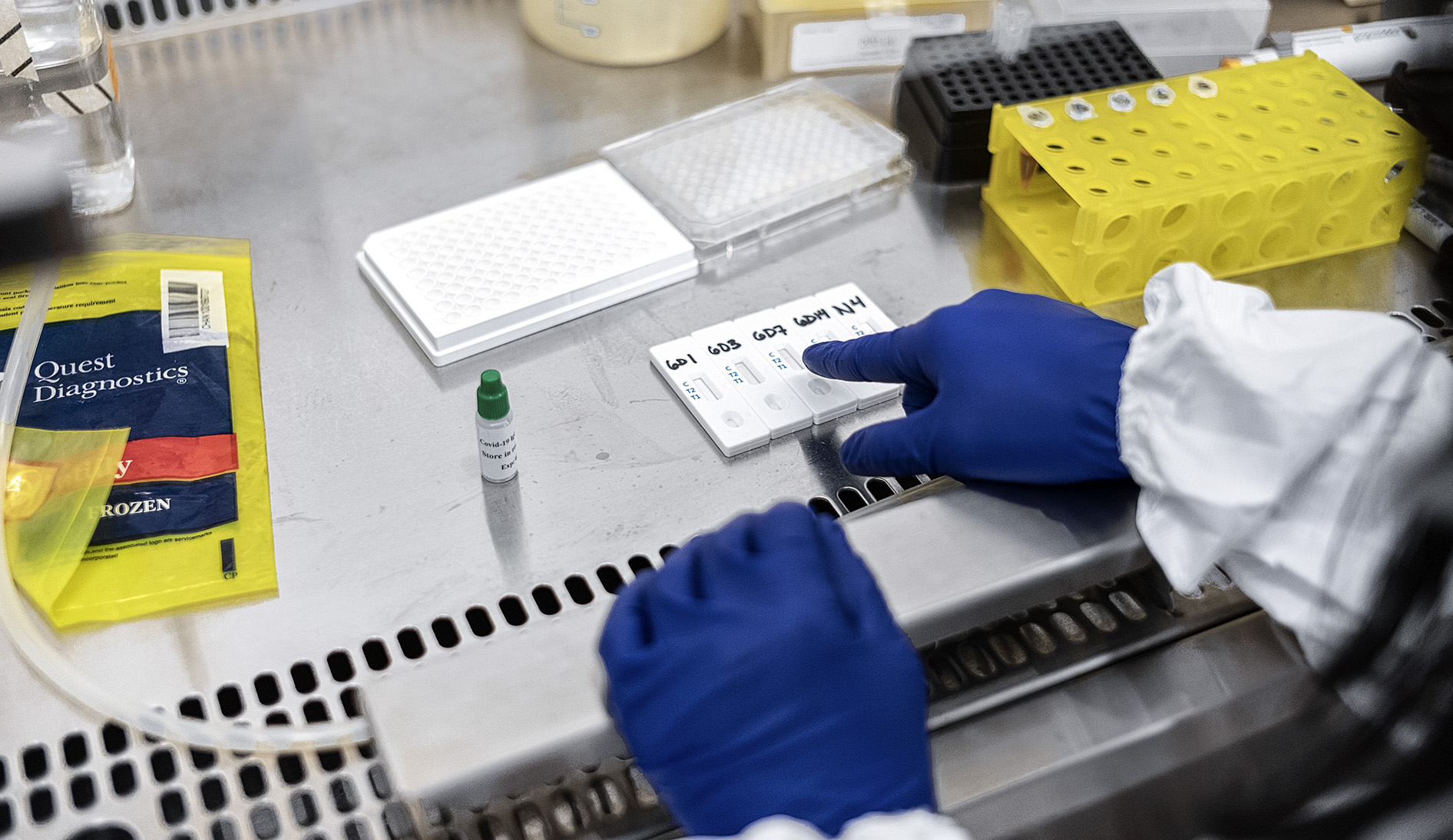 Testing for Covid-19? All you need to know about antibody tests