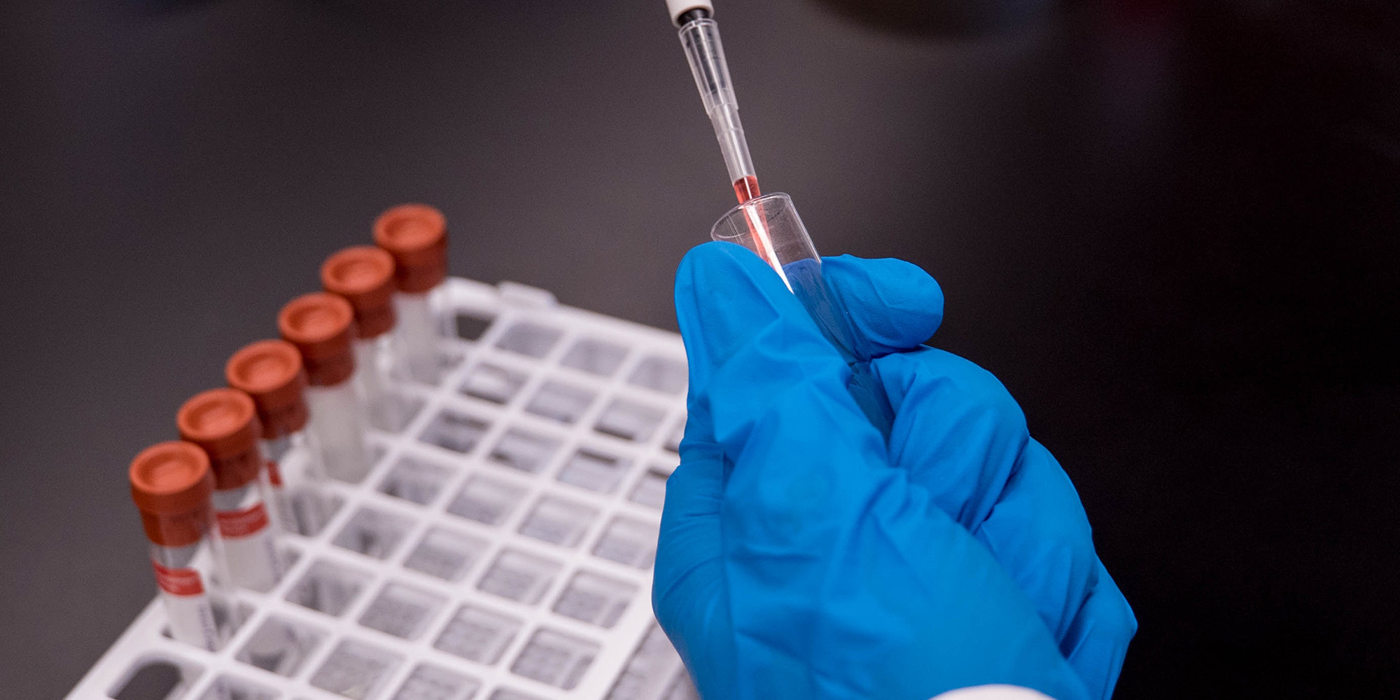 Bringing antimicrobial research and development to Africa – the time is now