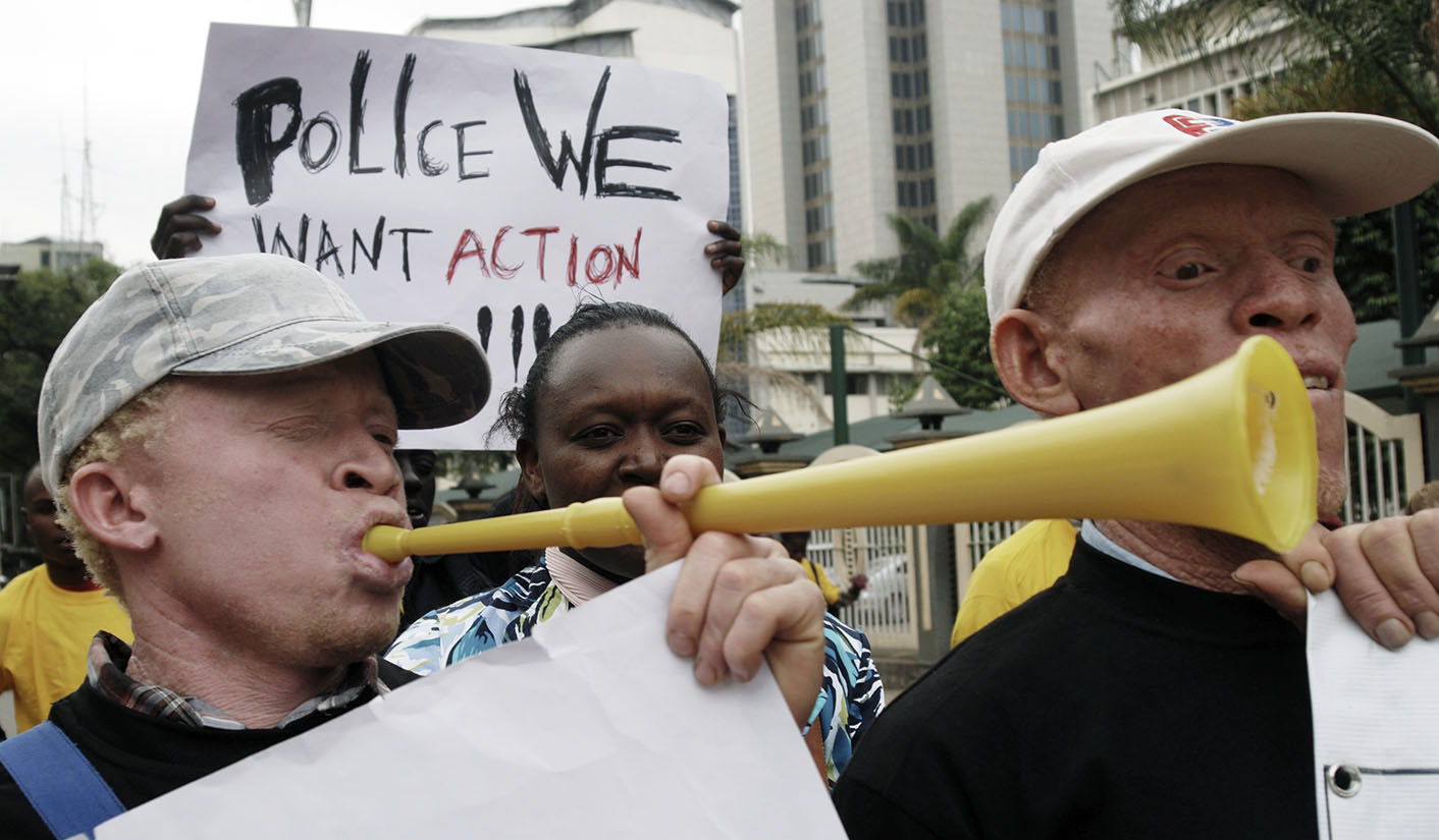 Murder and mutilation of people with albinism continues despite SADC motion – Amnesty International