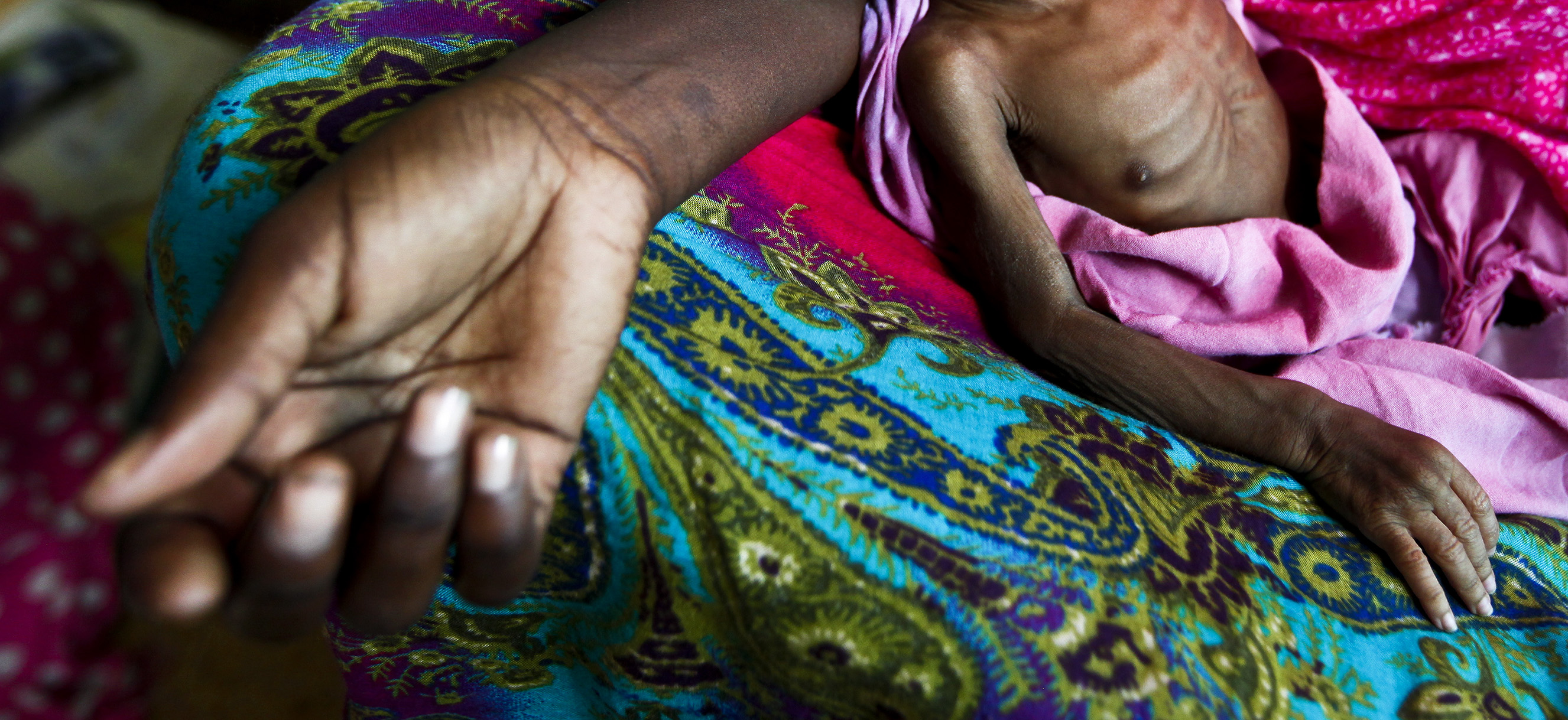 Malnutrition, health services and democracy: The responsibility to speak out