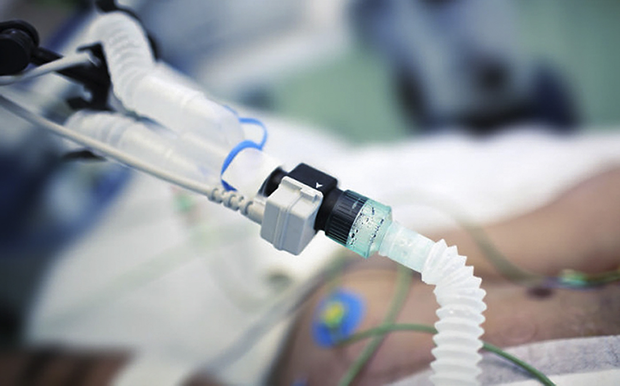 Covid-19: How high-flow nasal oxygen is saving lives and sparing some patients the trauma of intubation