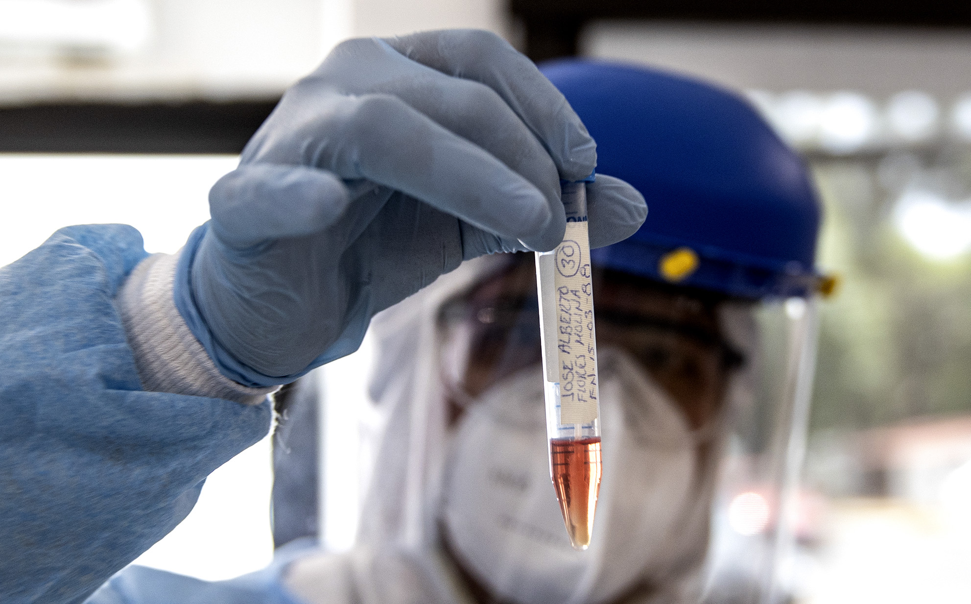 Covid-19: An antibody-based serology test provides little to no real-time value