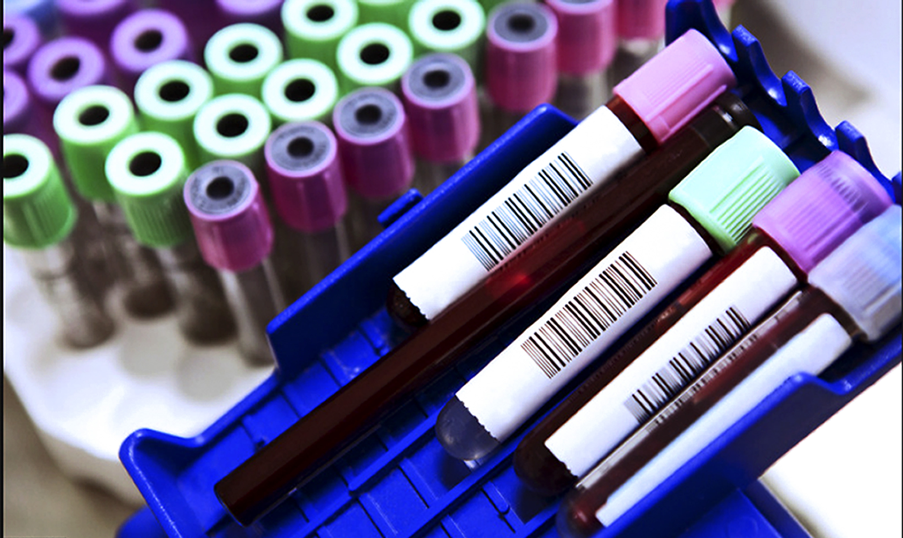 Health boost: New TB testing strategy improves diagnosis in clinics by 17%