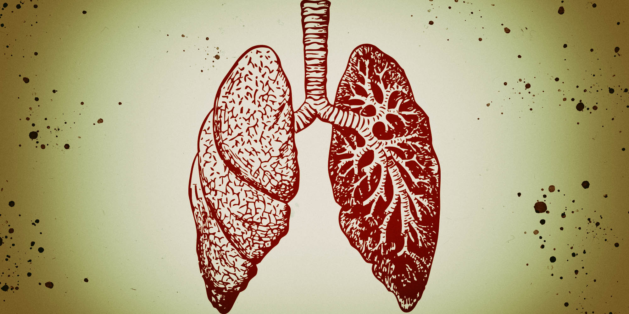 South Africa: 63,000 TB deaths in 2018