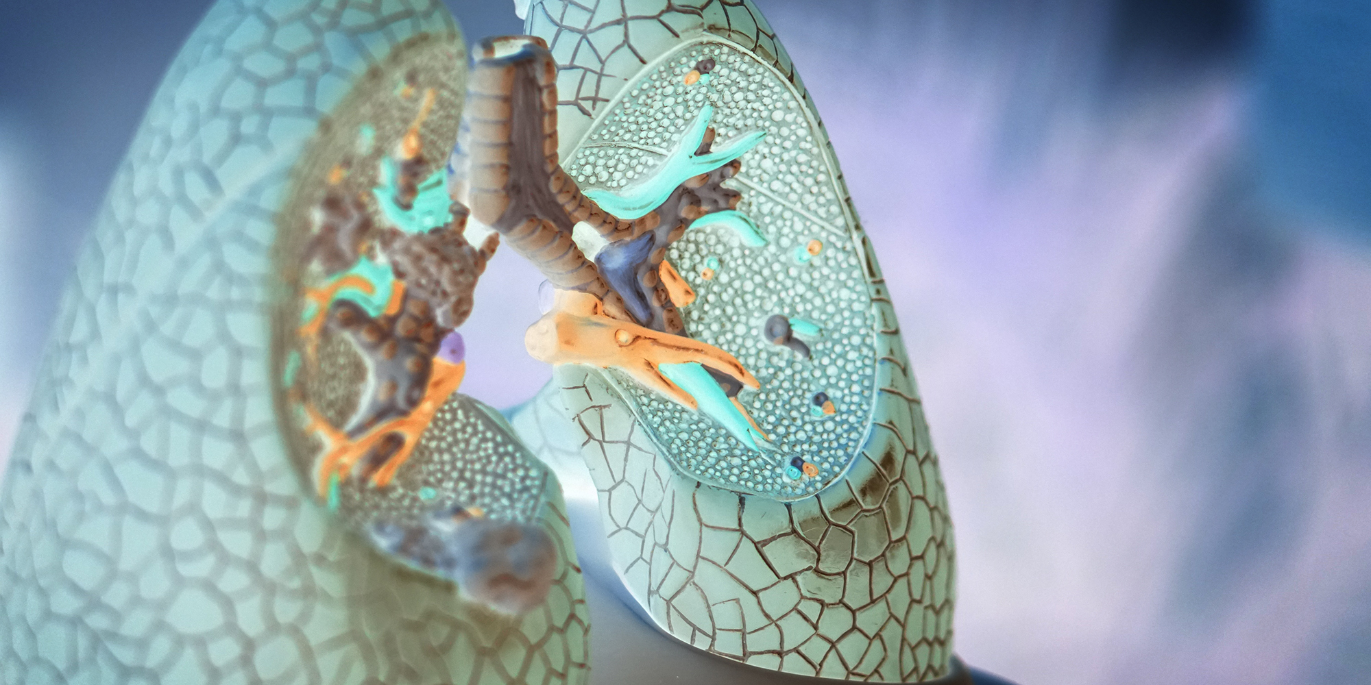 Global TB community must unite – 1.4 million lives are at stake