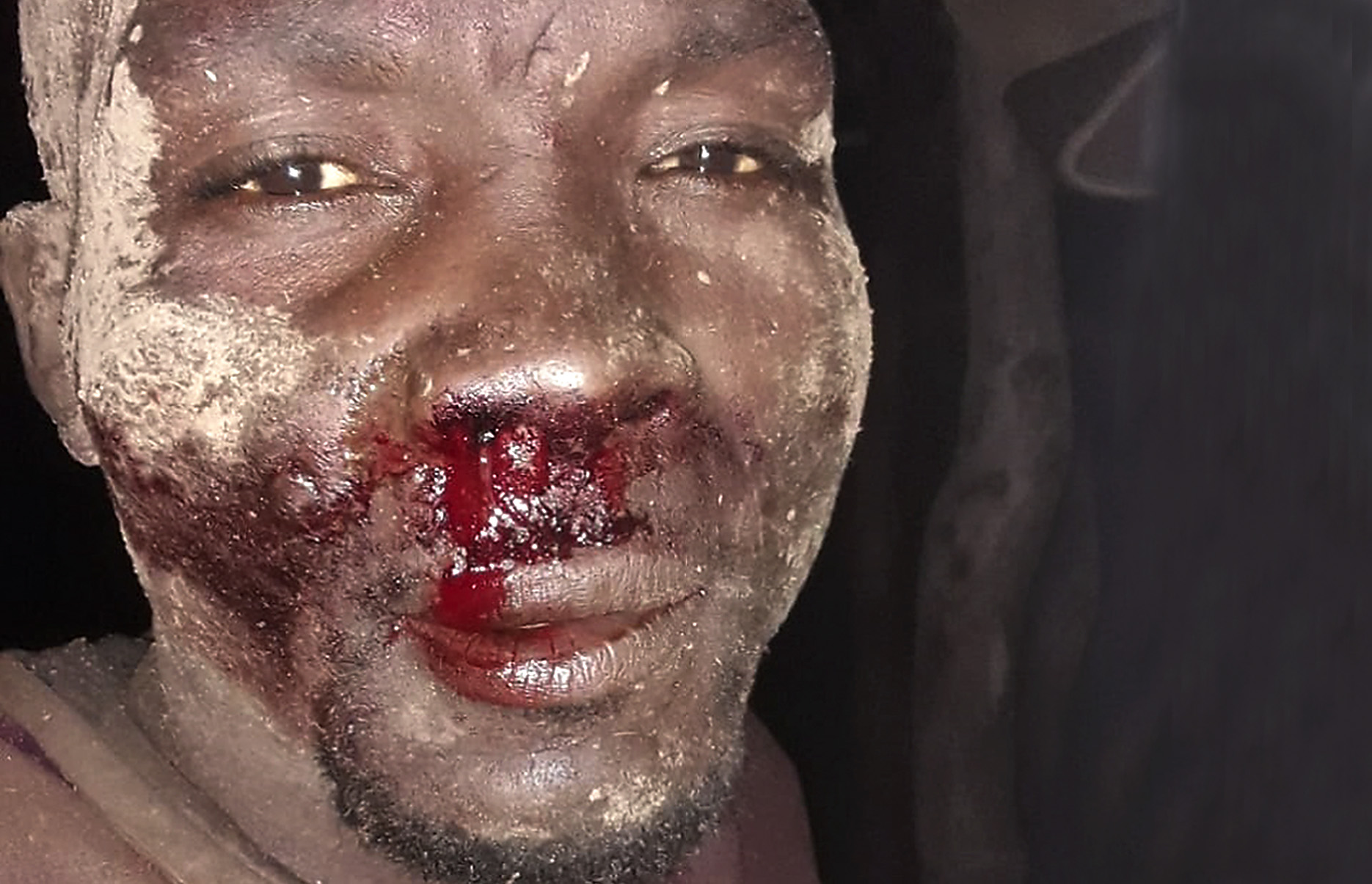 SANDF’s attacks on Gauteng’s Happiness Valley: A stark reminder of racialised denials of dignity and the limitations of the law