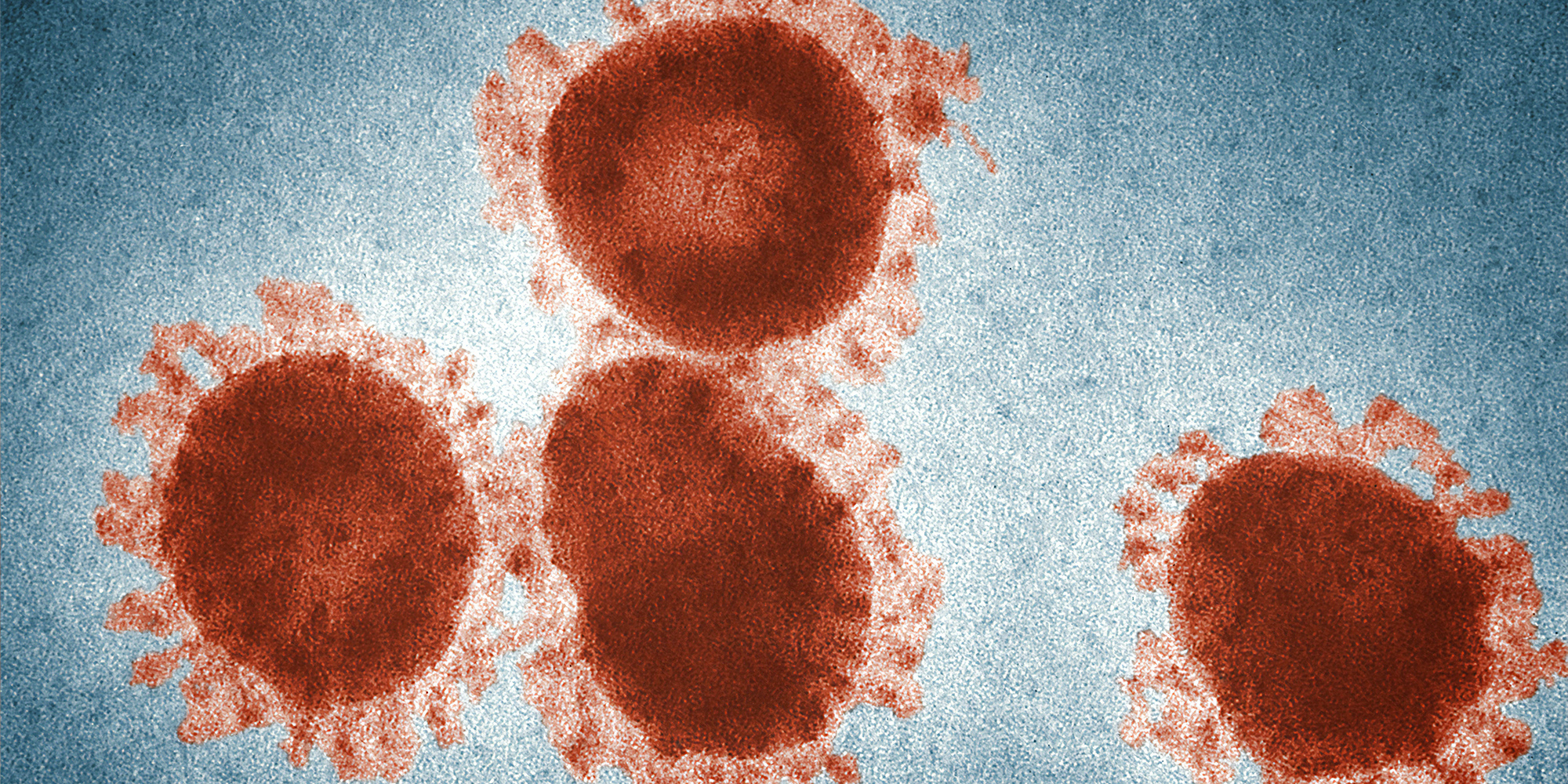 MC-estelle-Covid-surge