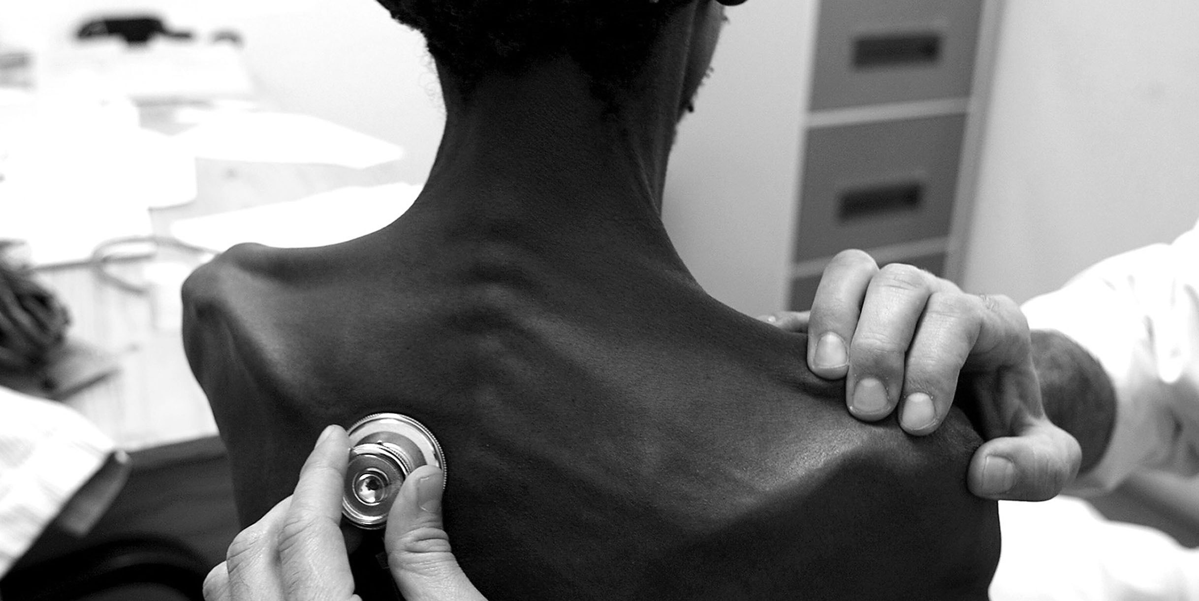 X-rays and AI could transform TB detection in South Africa, but red tape might delay things