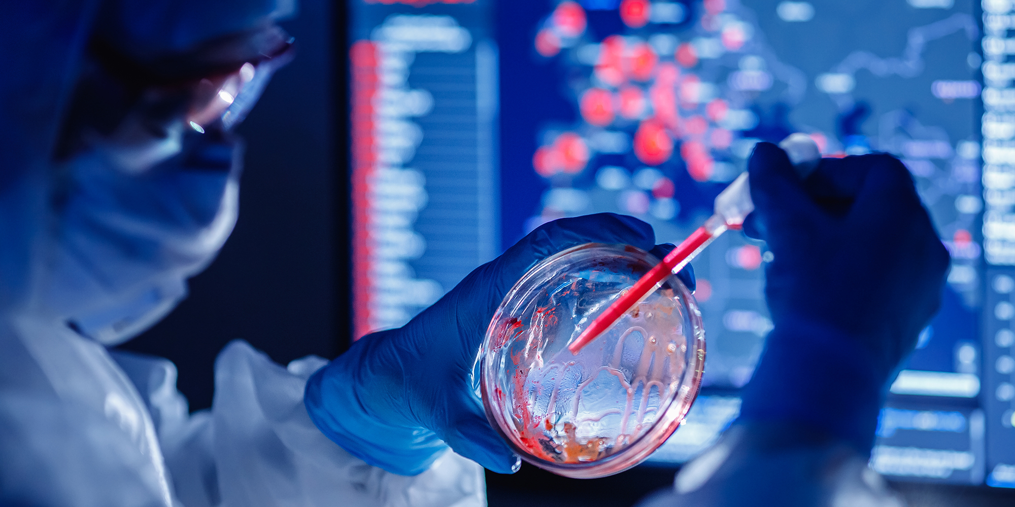 Wastewater surveillance is an early-warning system for Covid-19 outbreaks