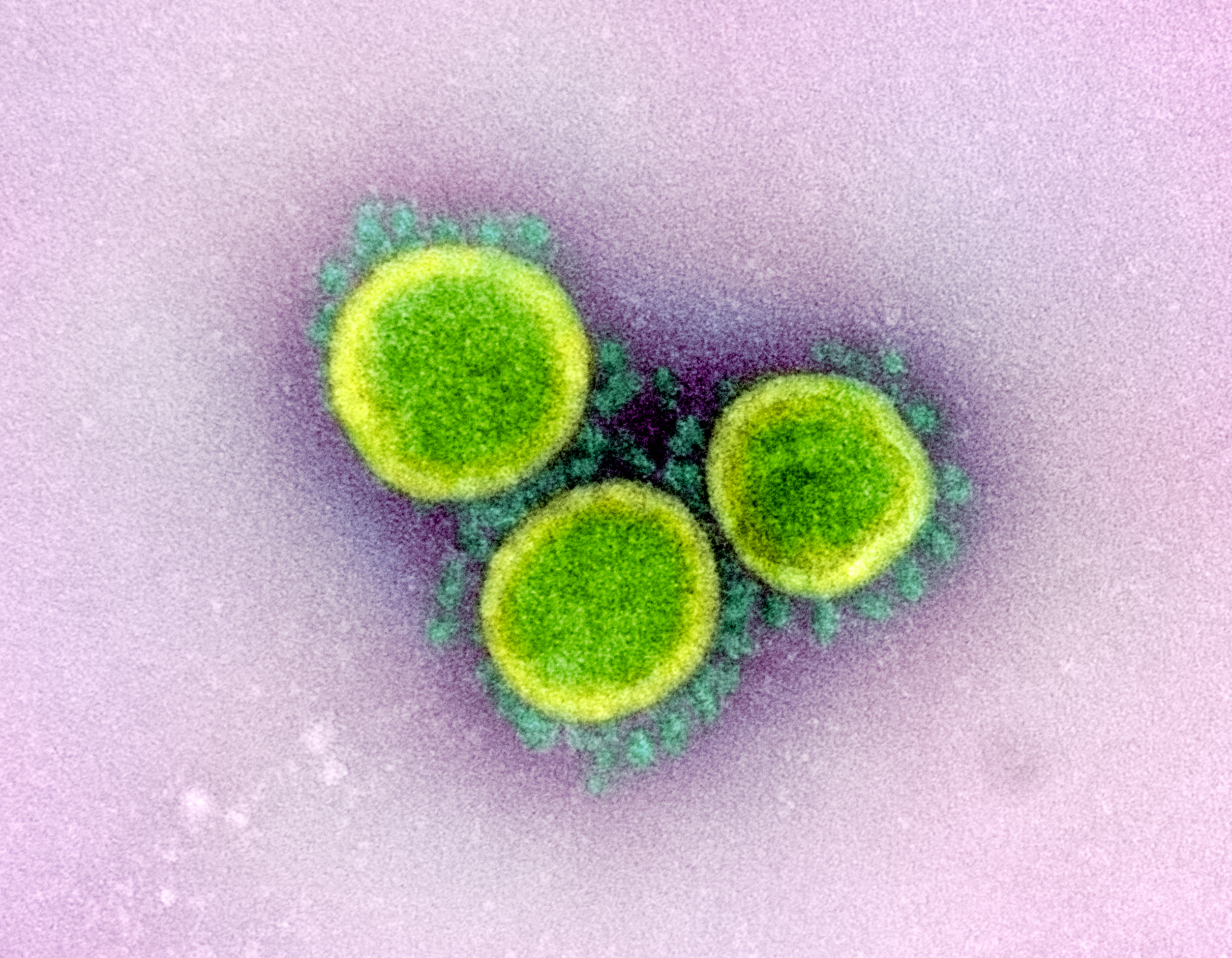 How we count our dead during Covid-19