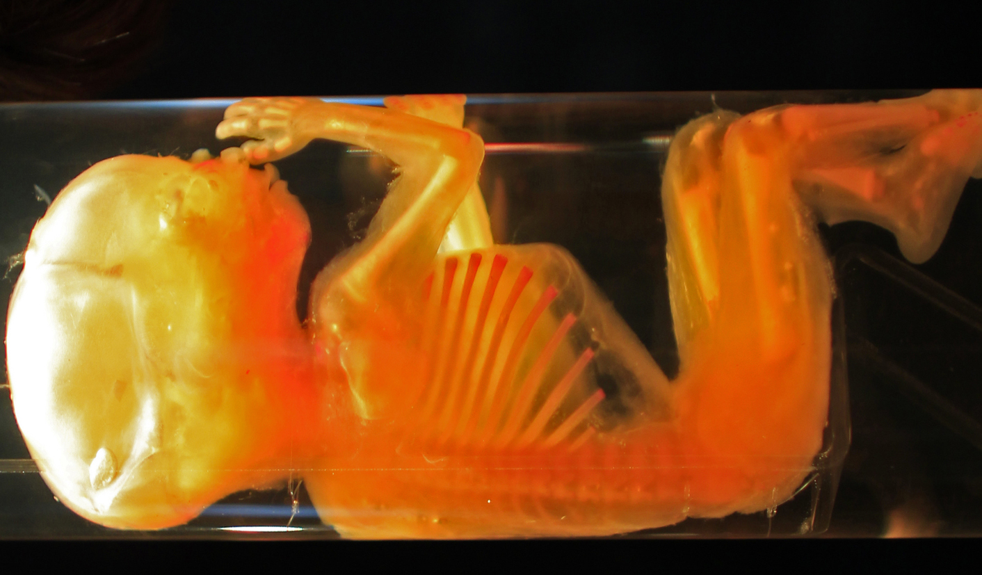 From a vial of mom's blood, a fetus's entire genome